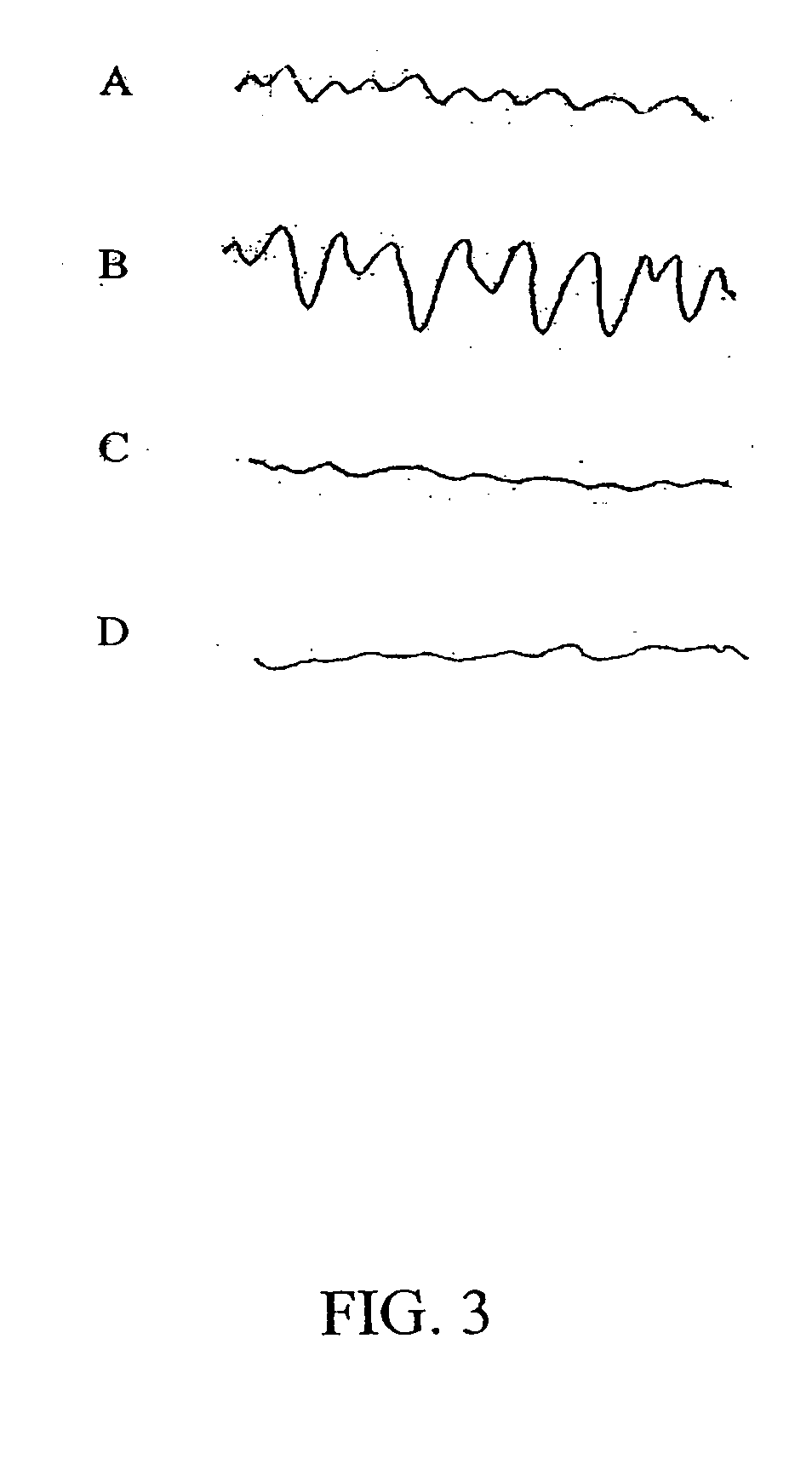 Methods and compositions for treating gastroparesis