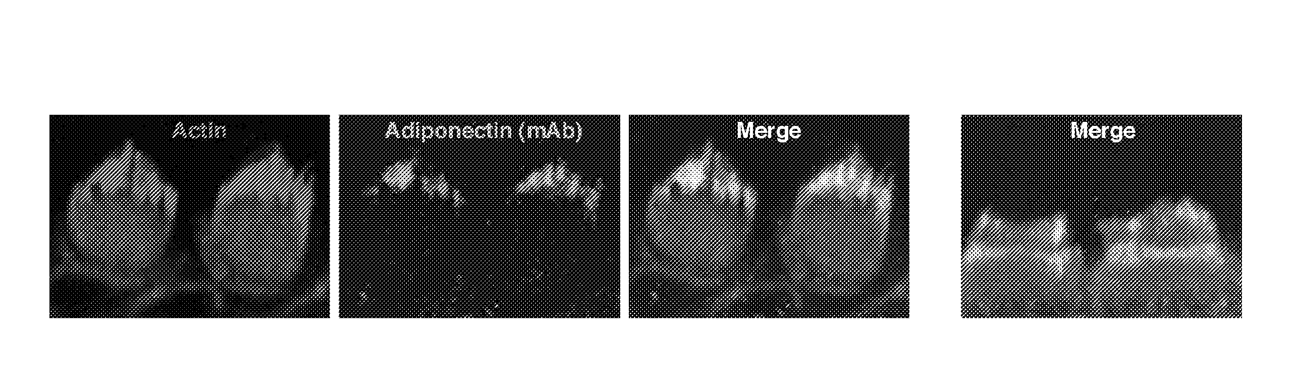 Use of adiponectin for the diagnosis and/or treatment of presbycusis