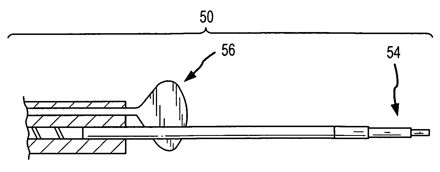 Apparatus and method for intragastric balloon with in situ adjustment means