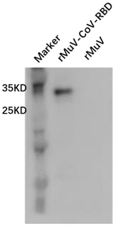 Novel coronavirus vaccine with mumps virus as live vector