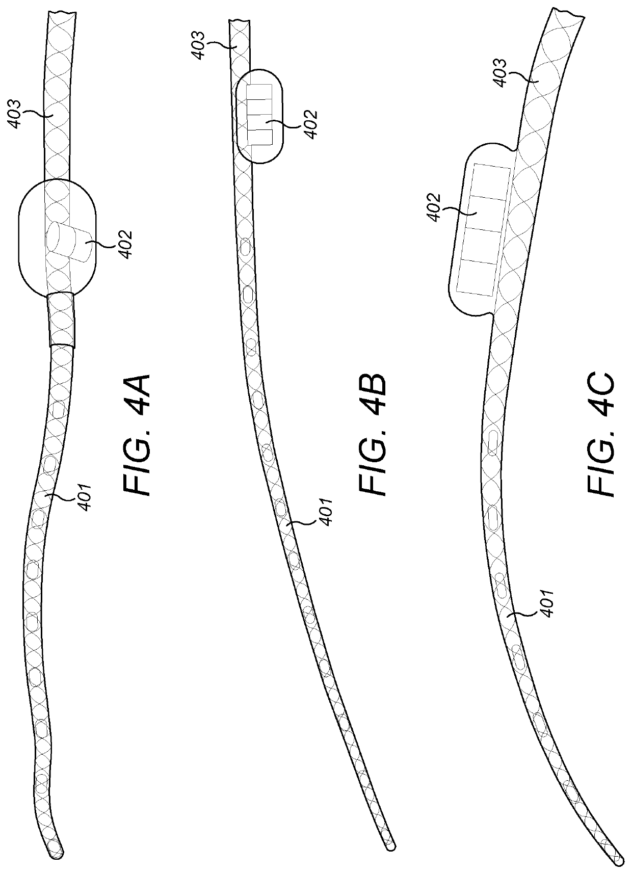 Middle Ear Implant Coupler for Mechanical Cochlea Stimulation via the Round Window