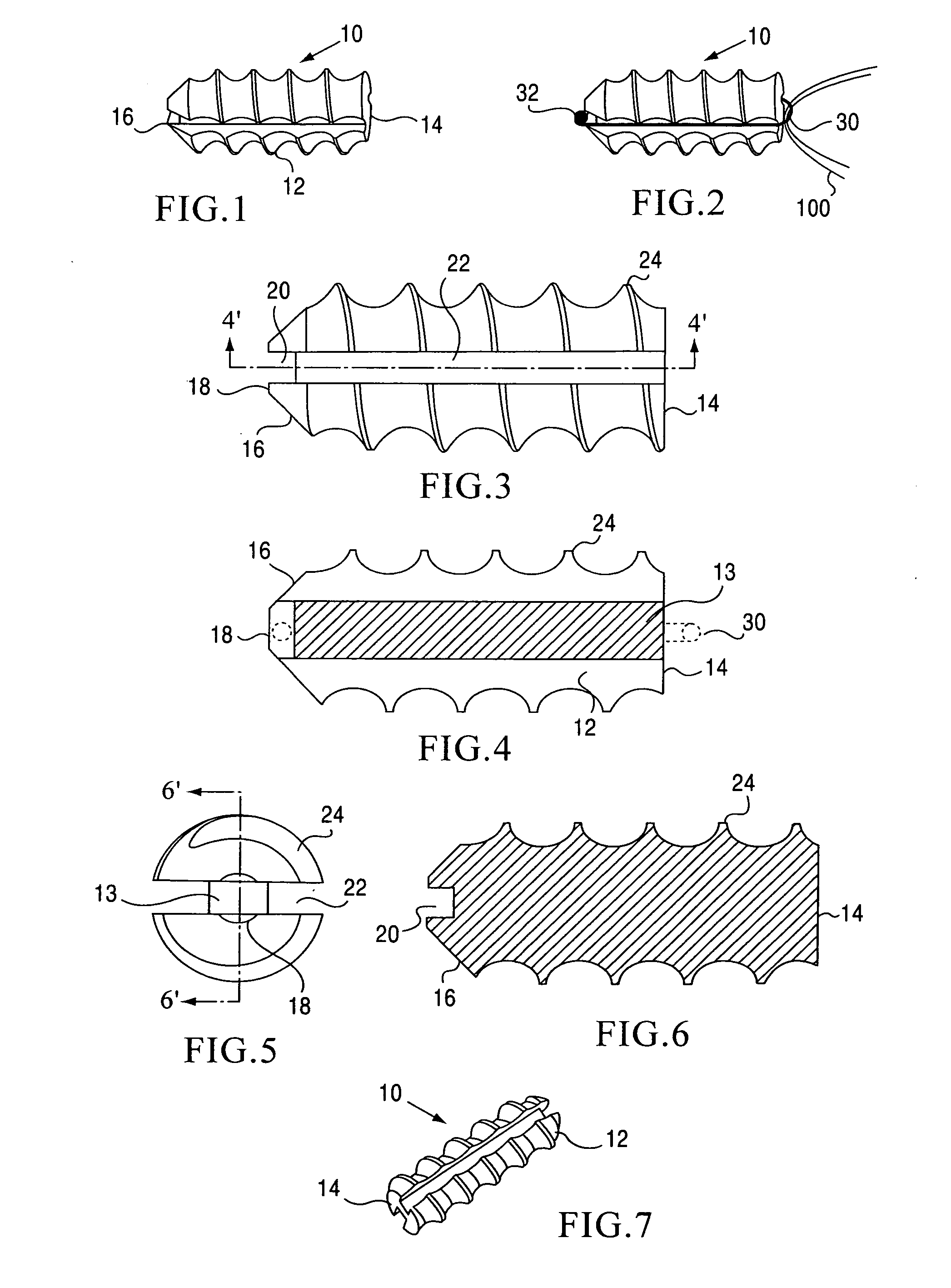 Threaded suture anchor and inserter device
