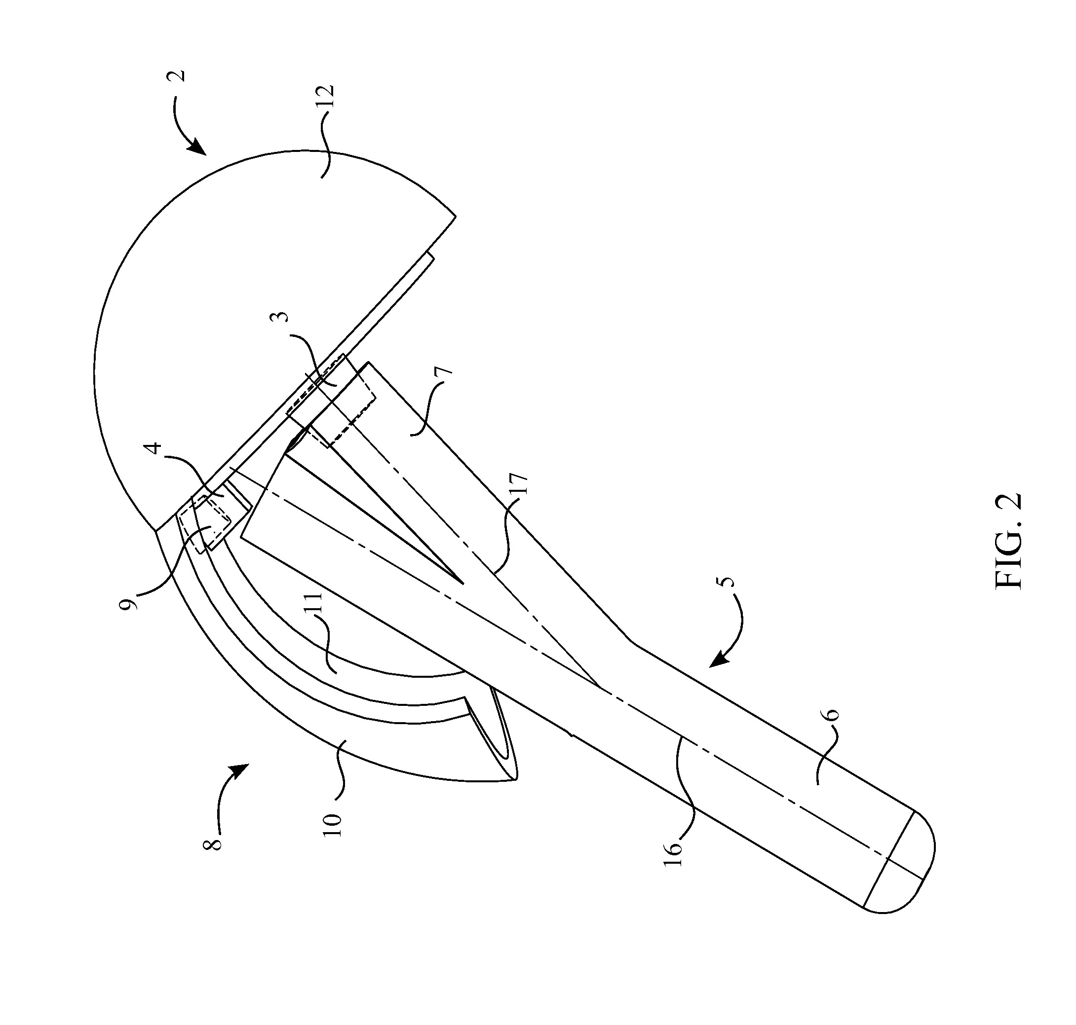 Extended Deltoid Tensioning Humeral Head