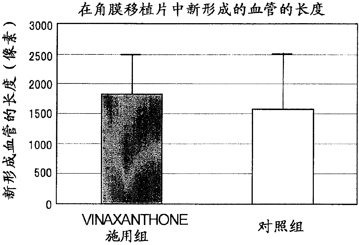 Therapeutic agent for corneal sensory nerve damage containing semaphorin inhibitor as active ingredient