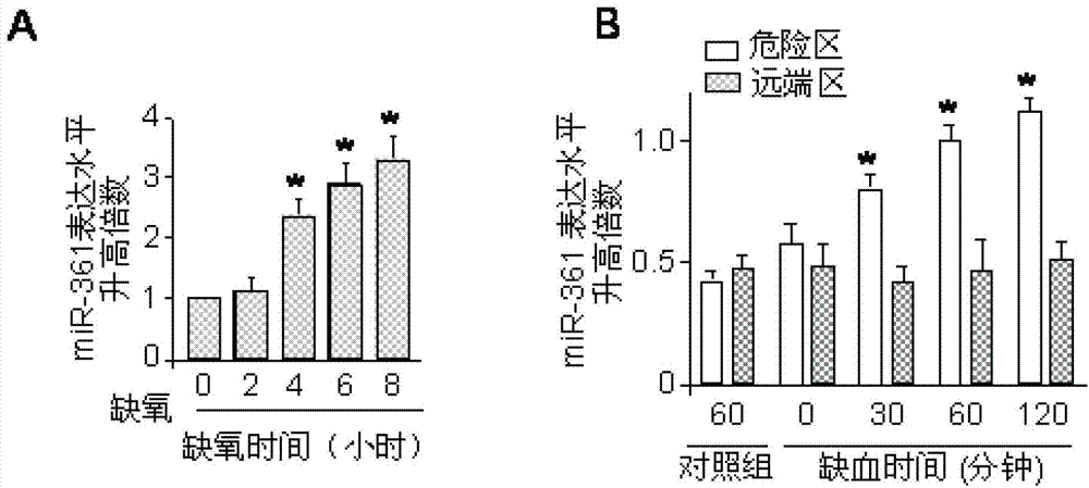 MiRNA-361 (micro-ribonucleic acid-361) and application of antisense nucleotide thereof