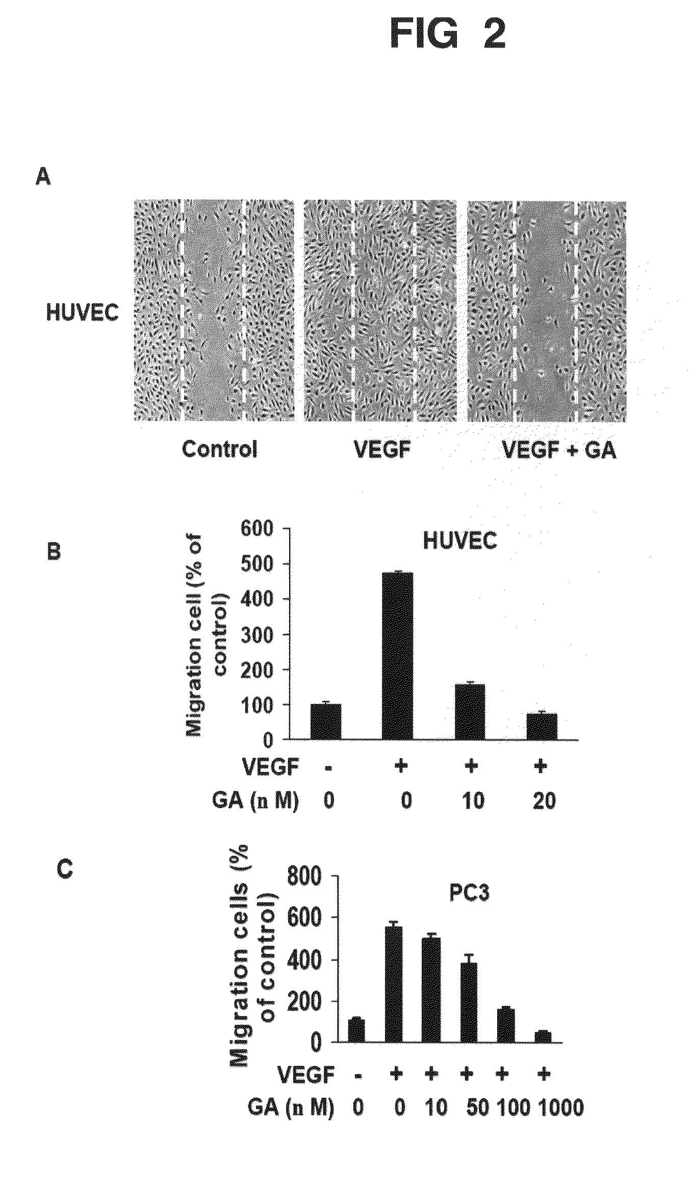 Methods and Compositions for the Treatment of Angiogenesis and Macular Degeneration