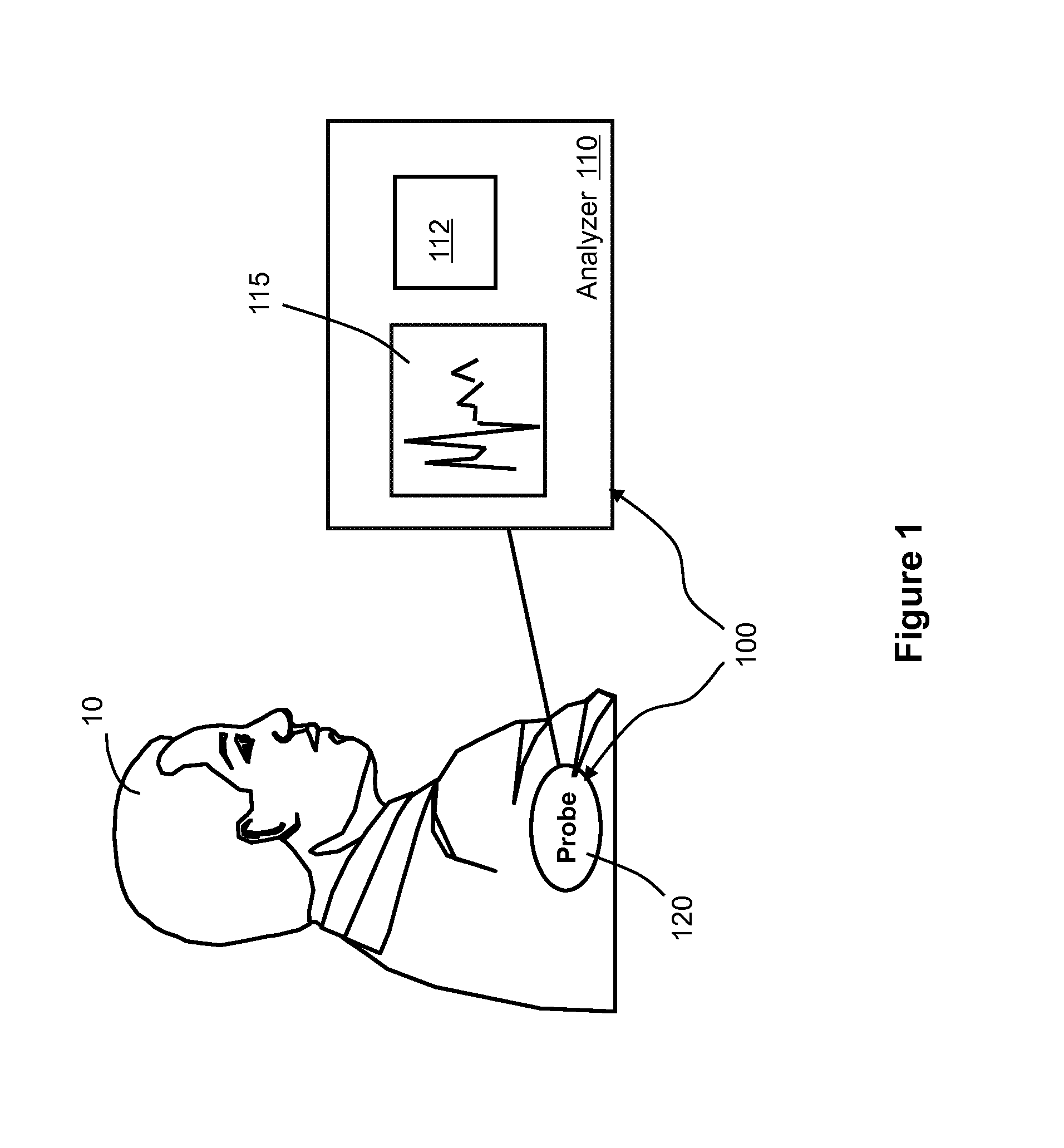 System and method for improved complex fractionated electrogram ablation
