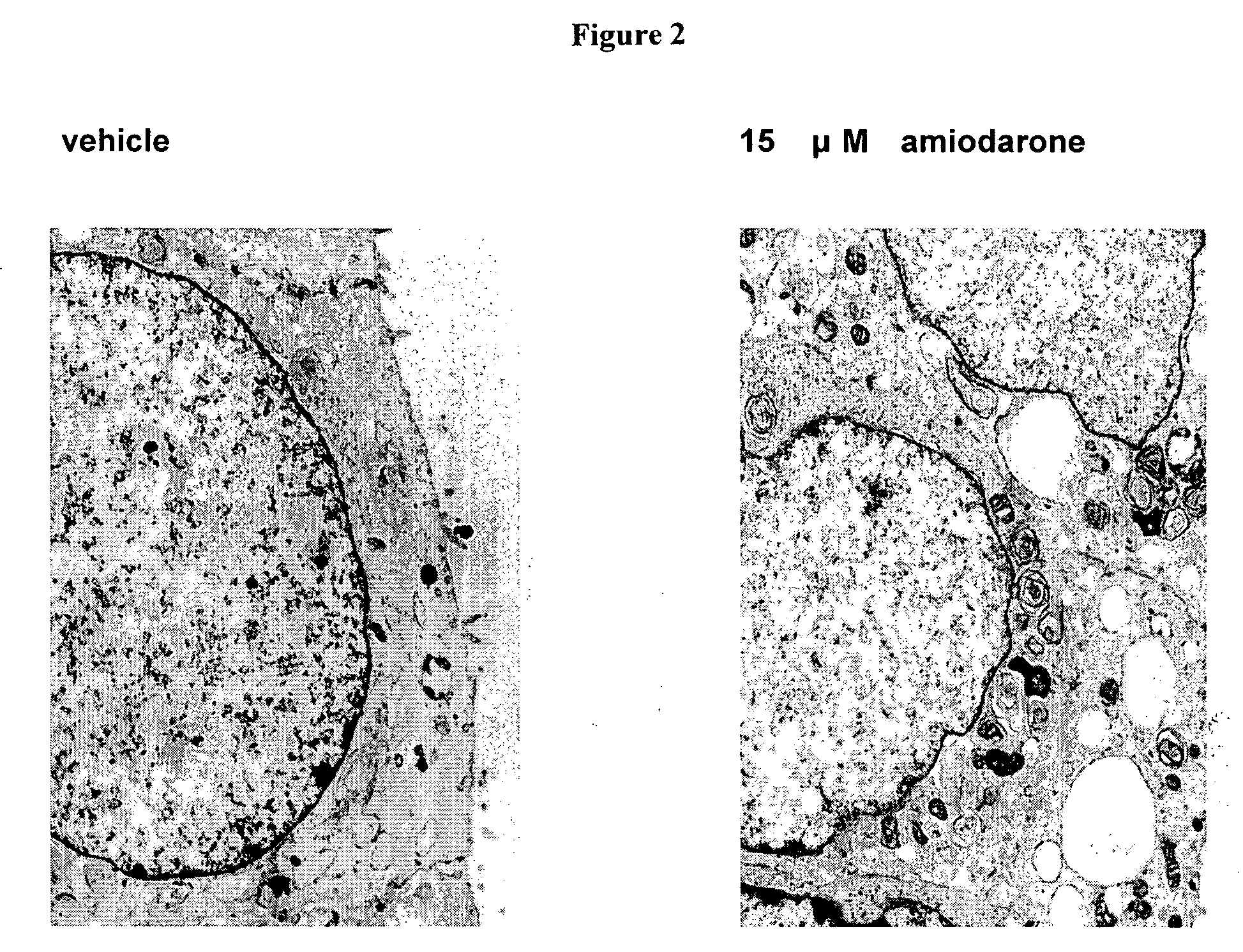 Methods and compositions for using aleveolar macrophage phospholipase A2