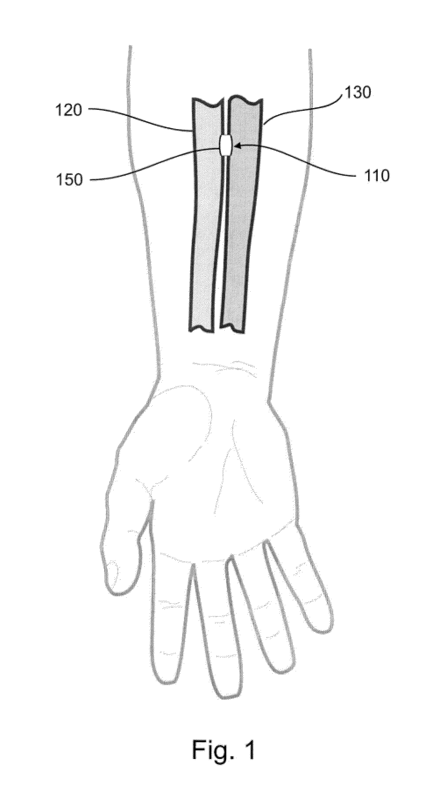 Devices, systems, and methods for peripheral arteriovenous fistula creation