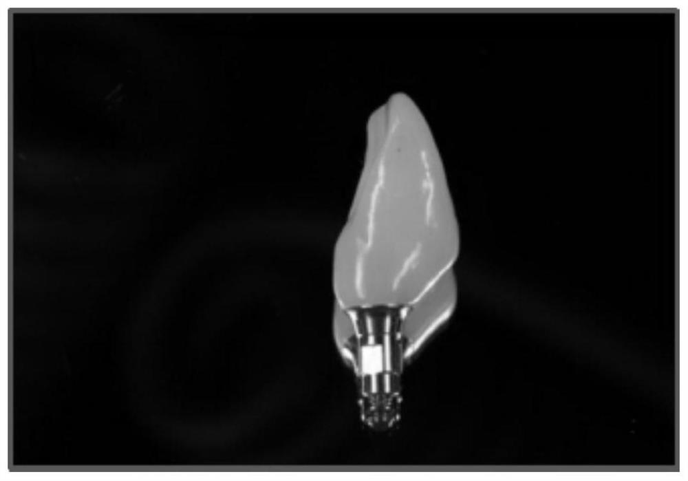 A personalized abutment-crown integrated temporary restoration and its preparation method and application