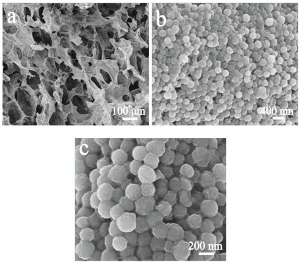 Spherical mesoporous calcium silicate/chitosan three-dimensional porous scaffold material, preparation method and application