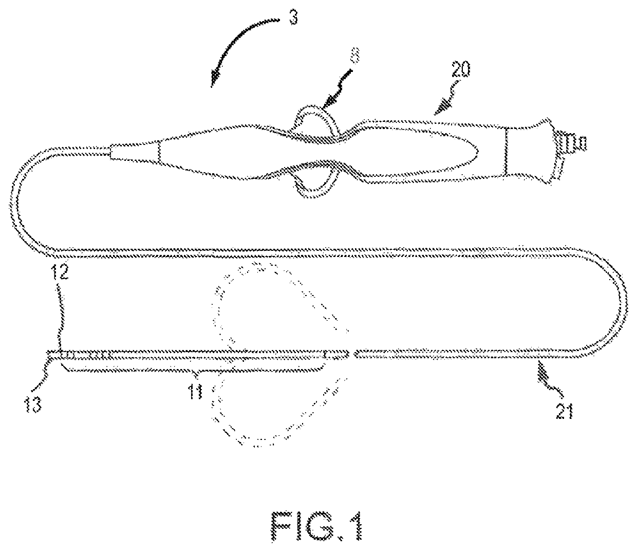 Deflectable catheter bodies with corrugated tubular structures