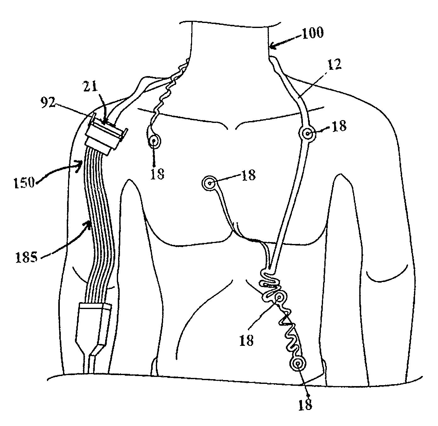 Radiolucent electrode assembly