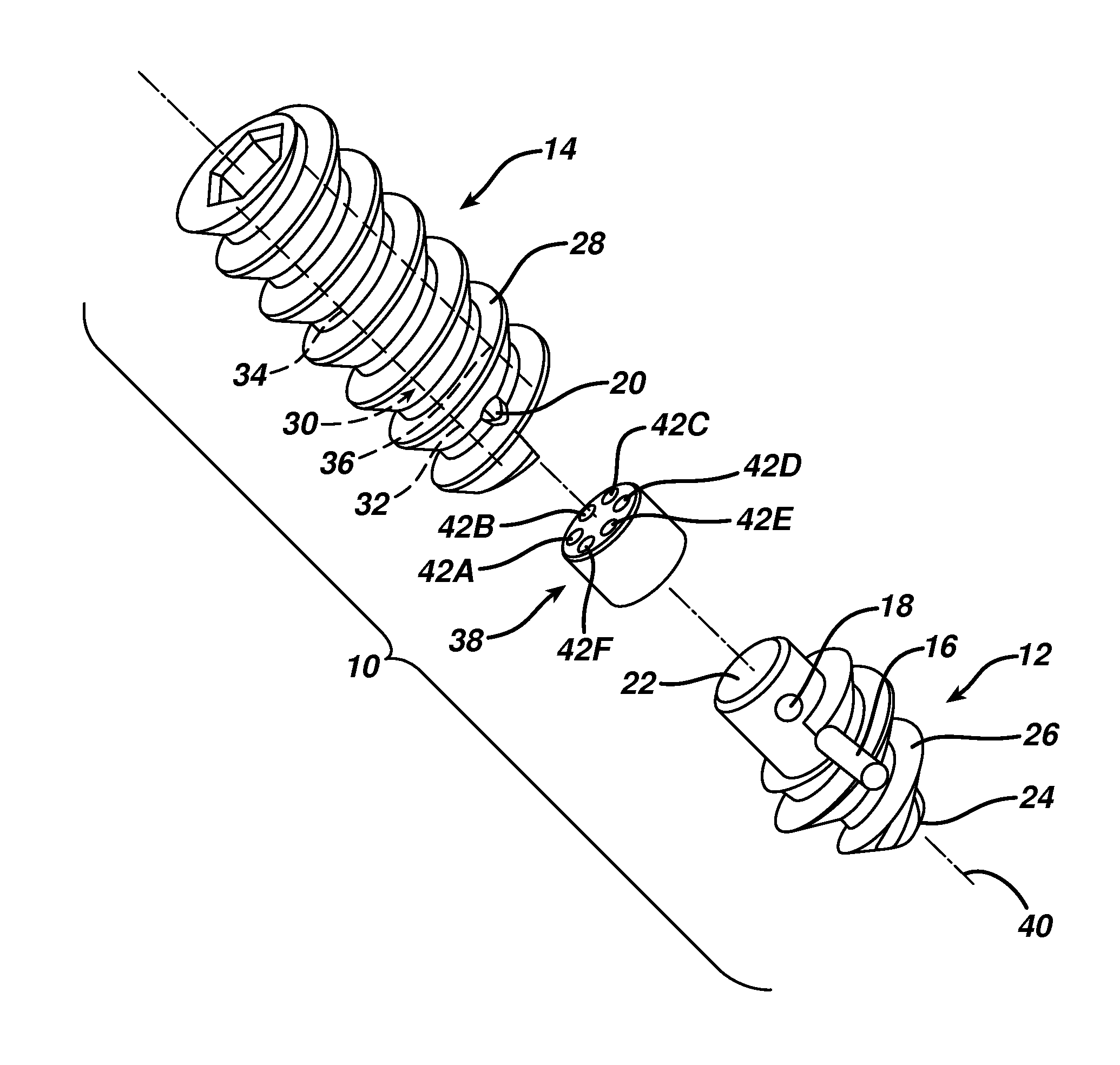 Suture anchor with suture management