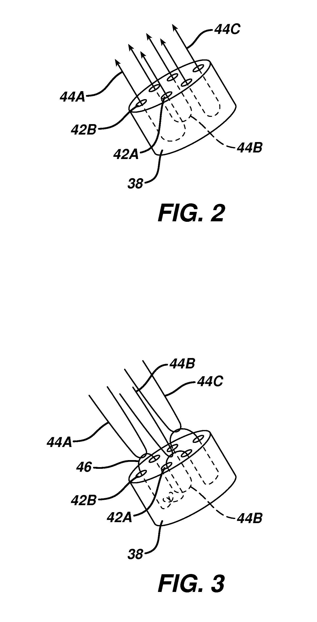 Suture anchor with suture management