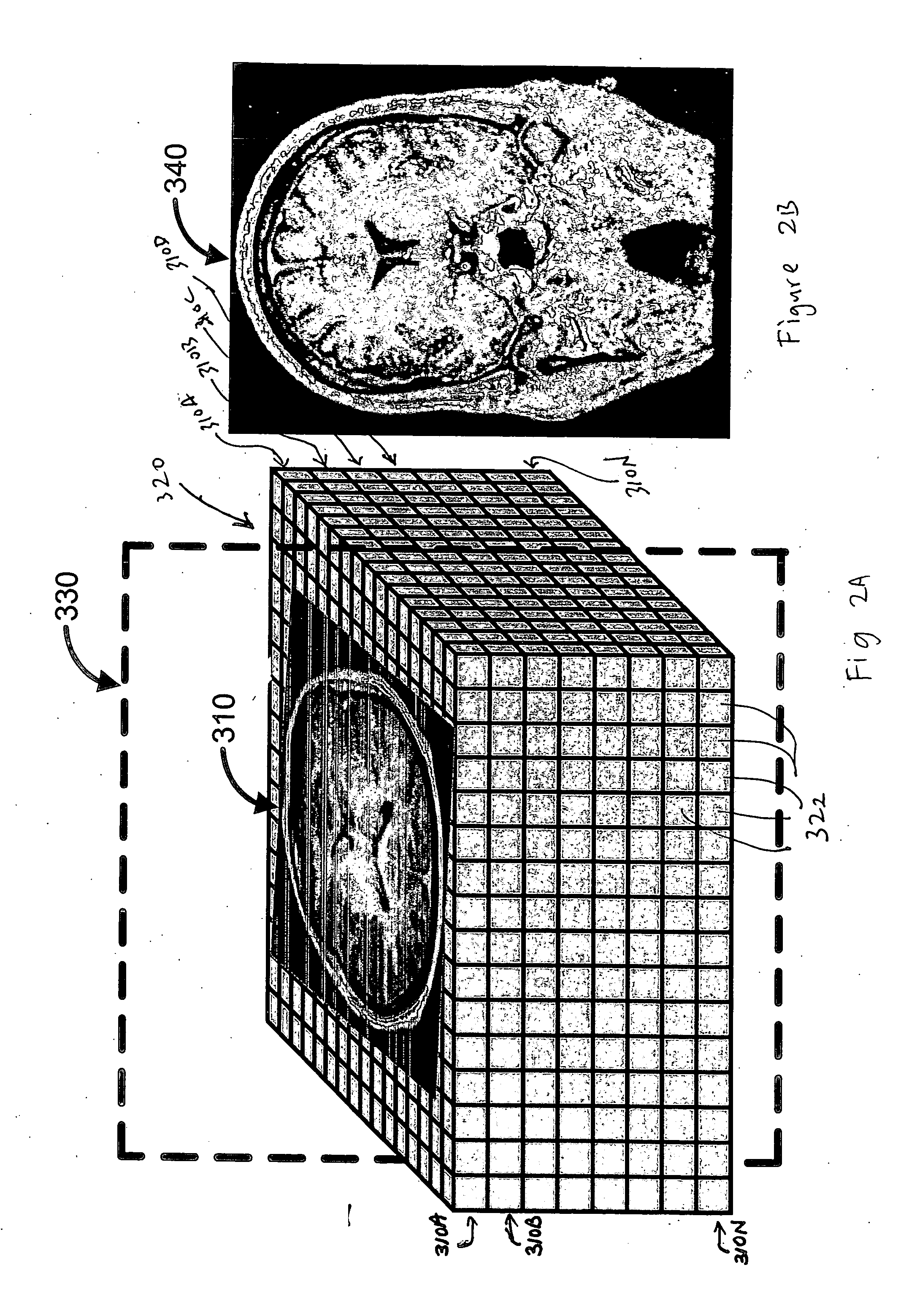 Systems and methods for viewing medical 3D imaging volumes