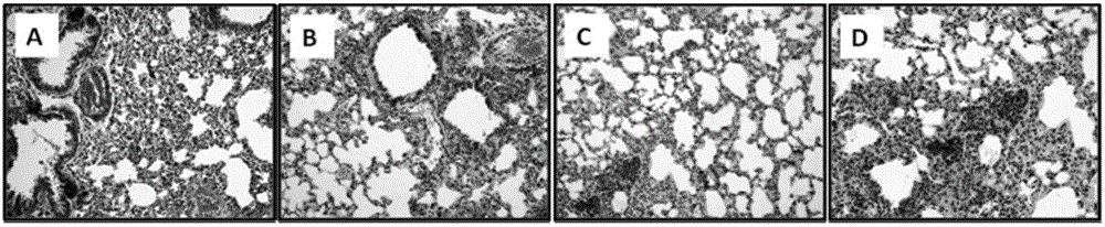 Medicine for reducing body injuries caused by influenza virus infection