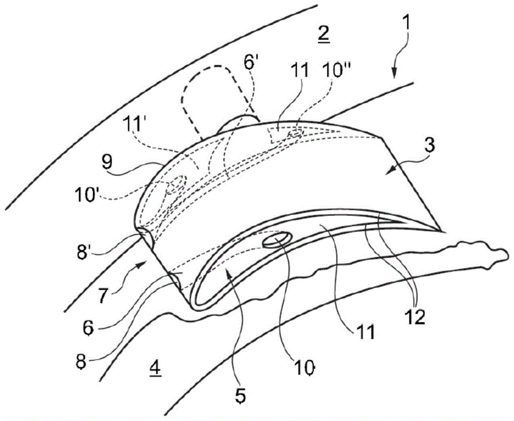 Variable geometry turbine/compressor