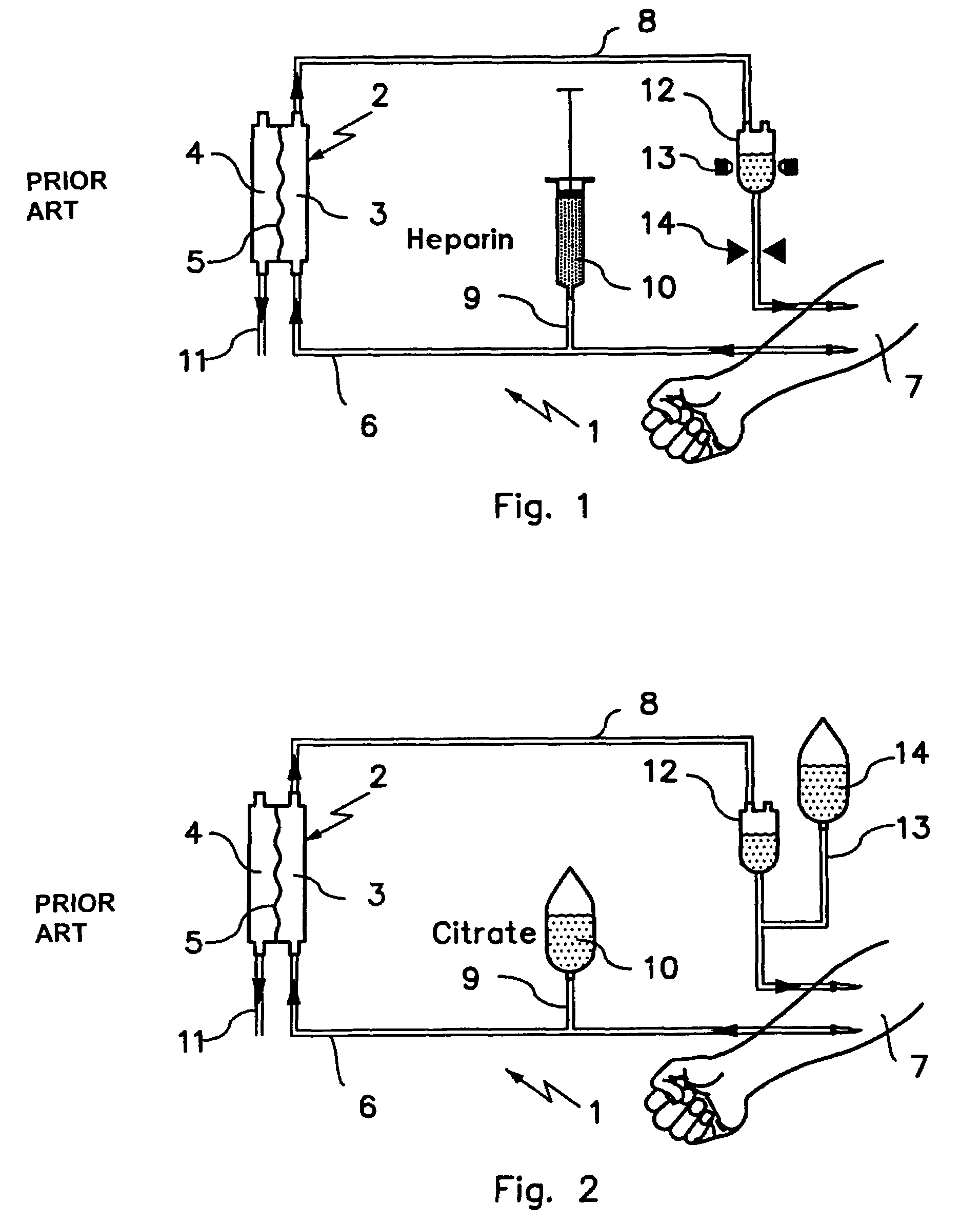 Device and process for extracorporeal treatment by citrate anticoagulant