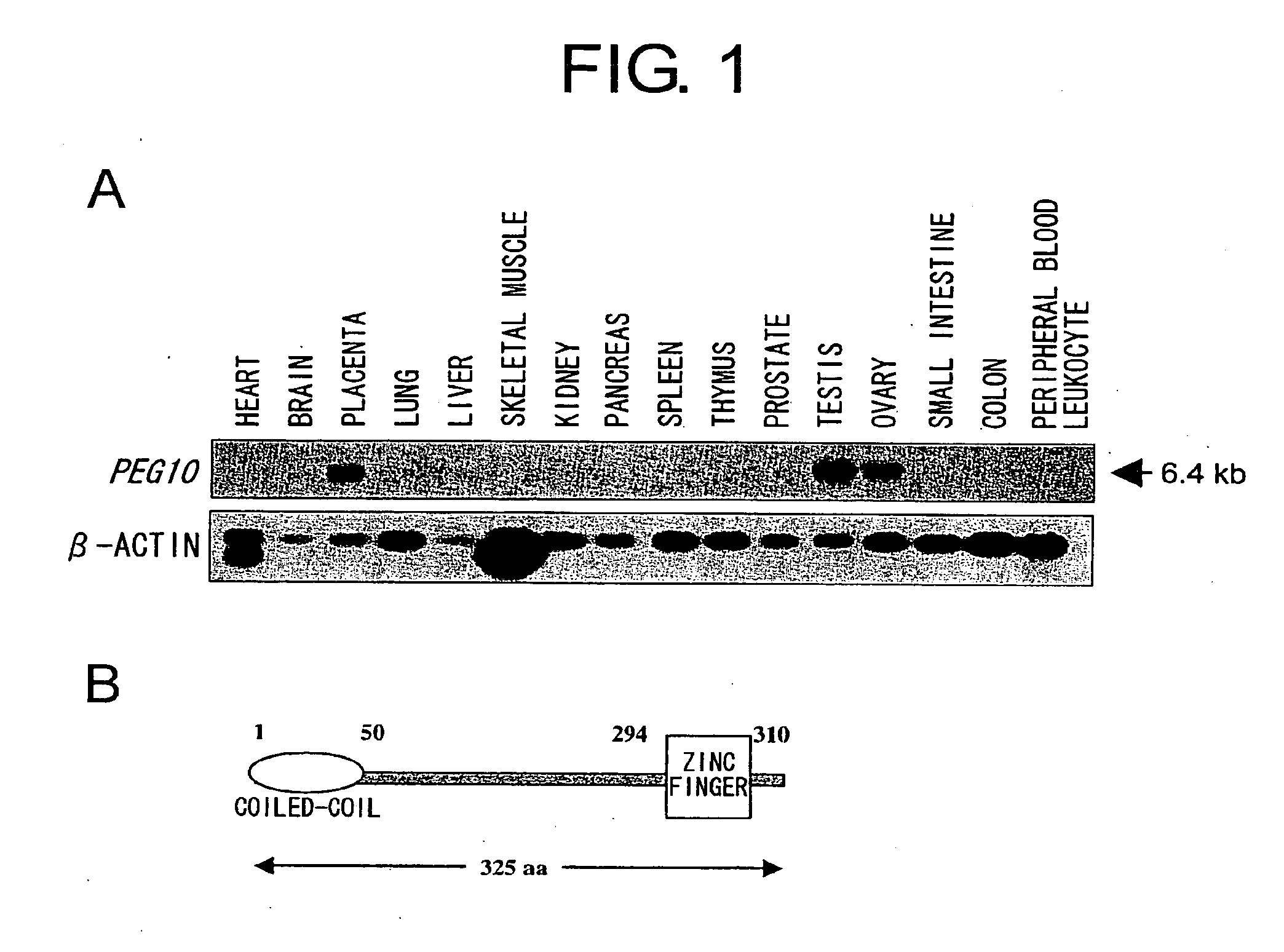 Methods of regulating growth and death of cancer cells