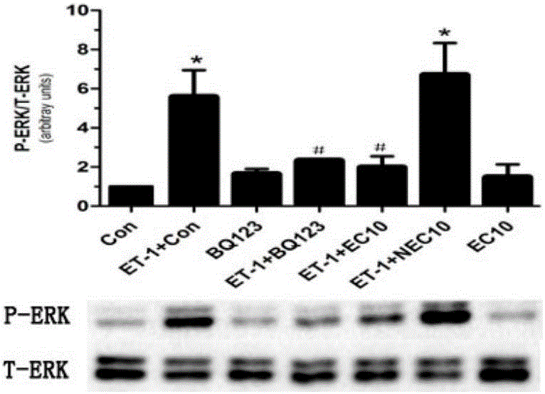 Human endothelin type-A receptor immunogenic peptide fragment and vector vaccine thereof