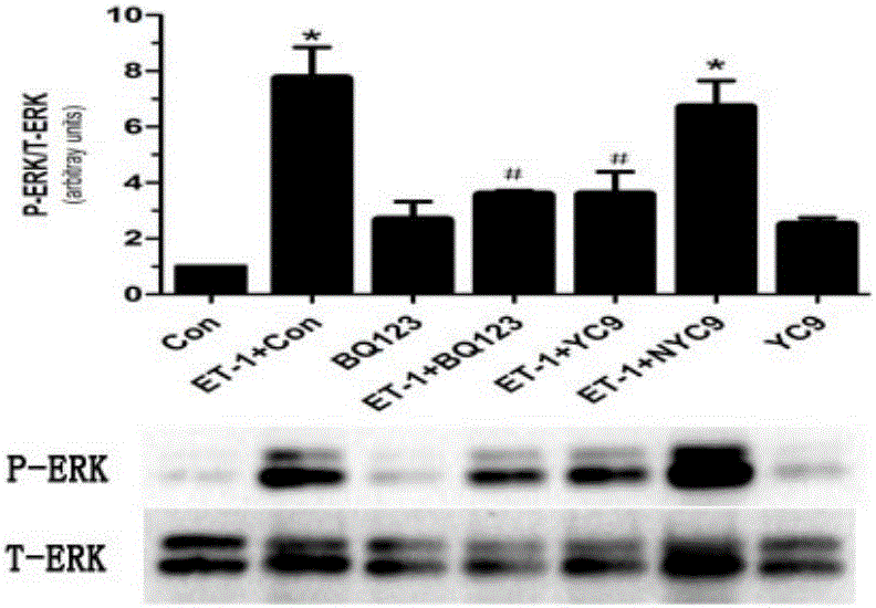 Human endothelin type-A receptor immunogenic peptide fragment and vector vaccine thereof