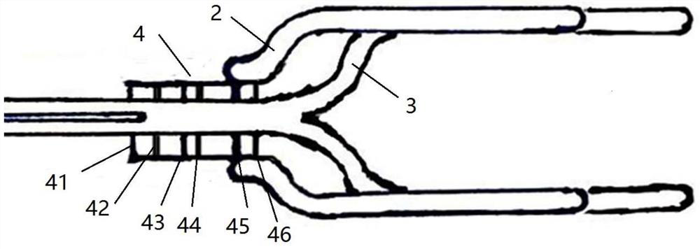 A Minimally Invasive Collagen Membrane Holder for Tissue-Engineered Cartilage Transplantation