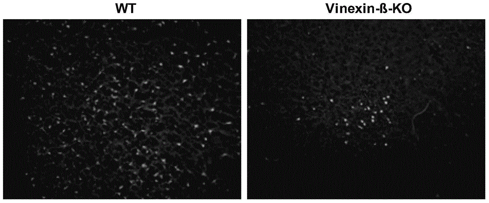 Application of Vinexin-beta in treating cerebral apoplexy