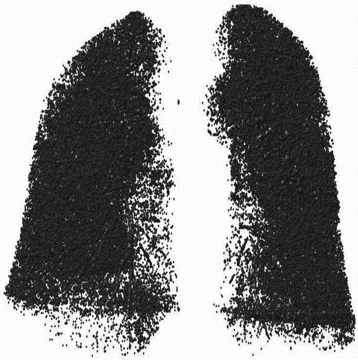 Method for extracting terminal bronchial tree from lung CT image