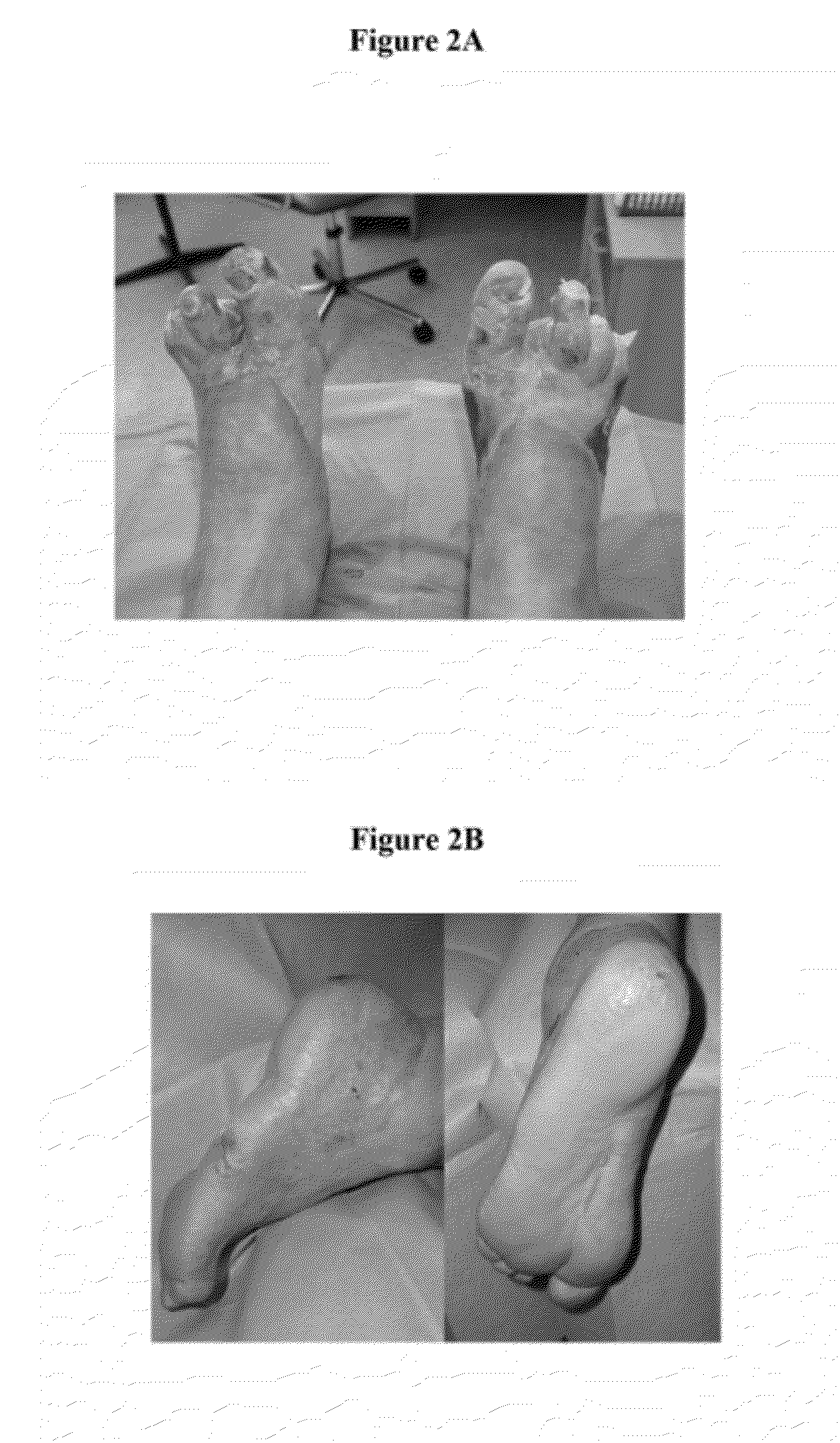 Methods and materials for treating burn injuries