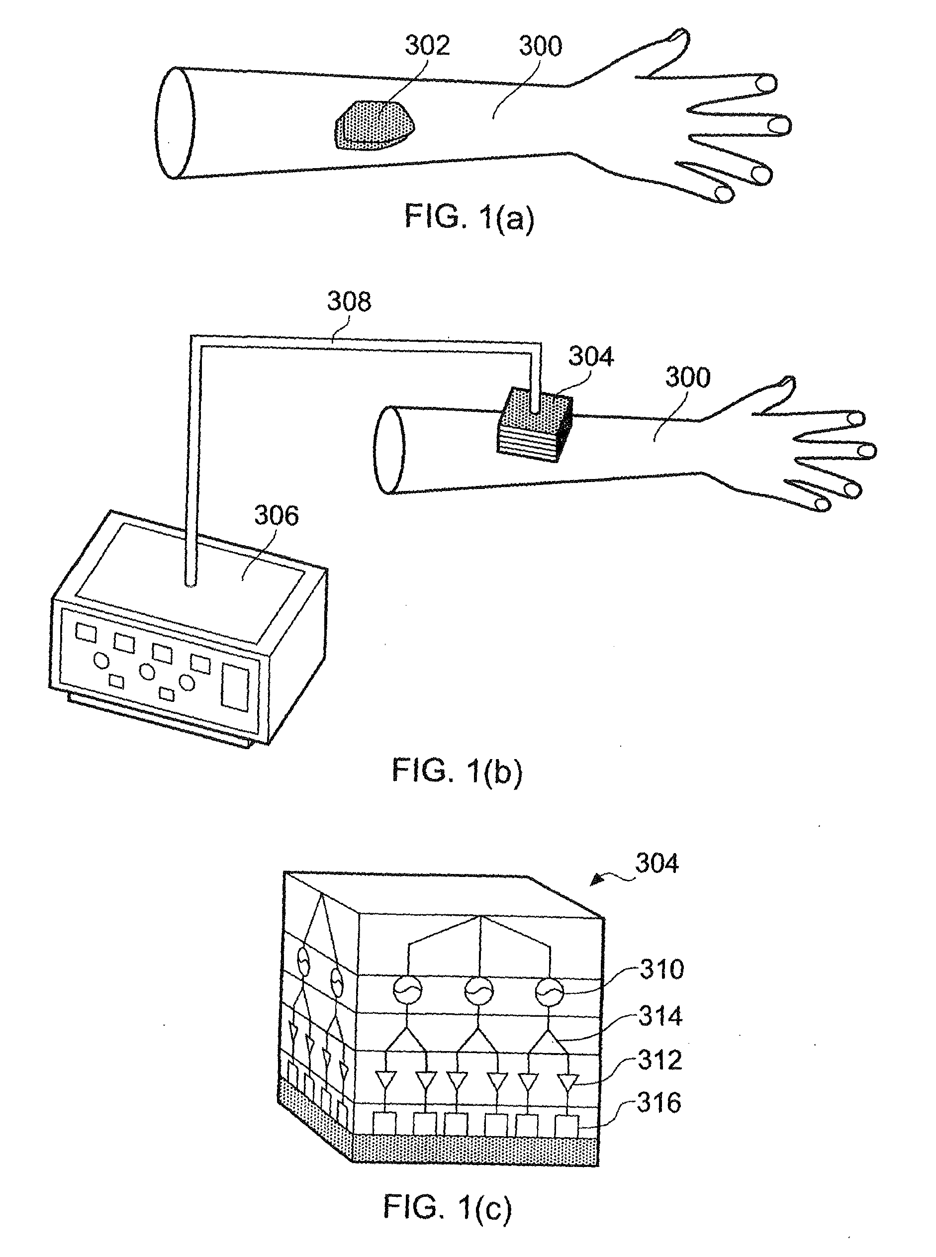 Microwave array applicator for hyperthermia