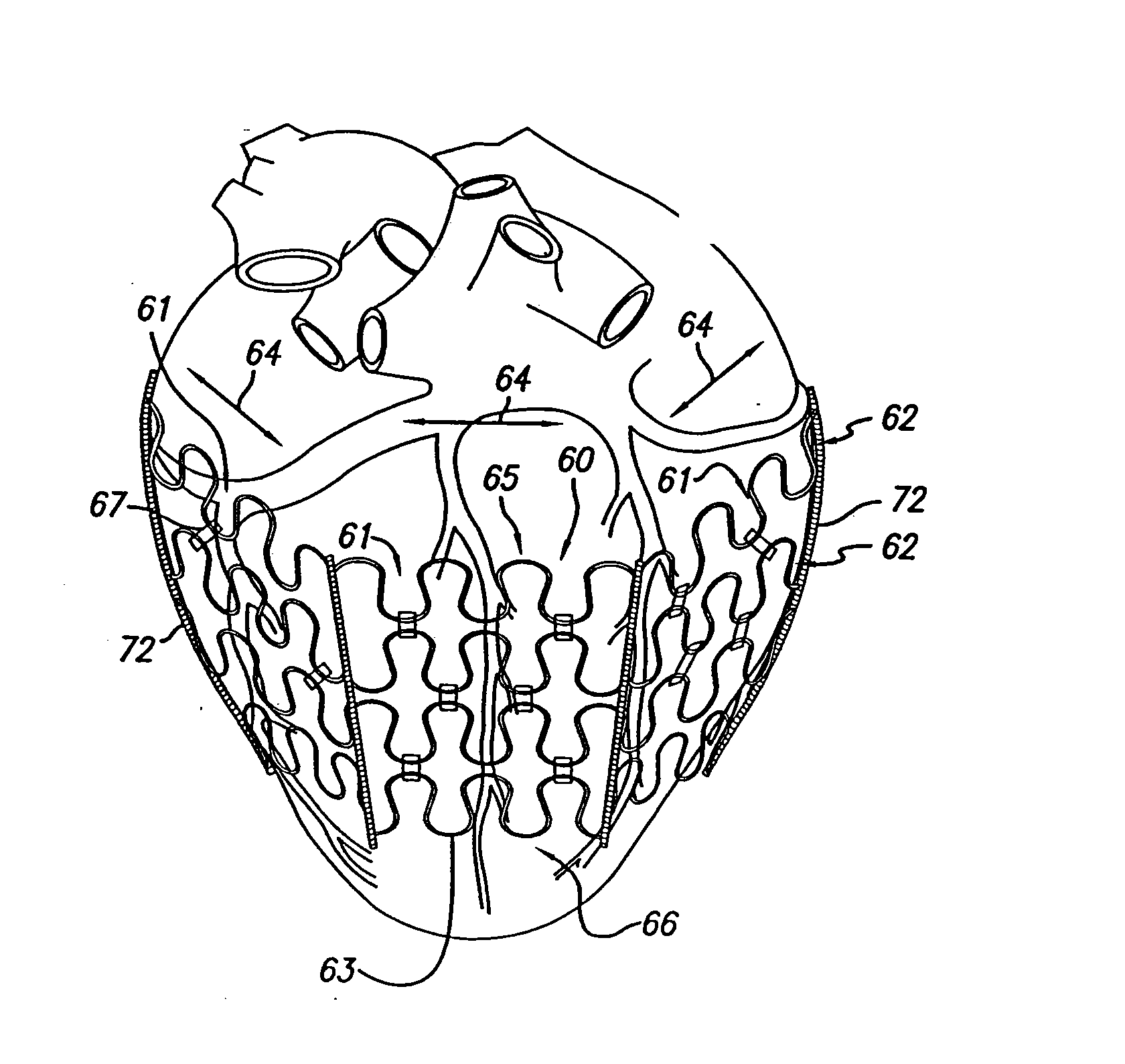 Delivery device for cardiac harness