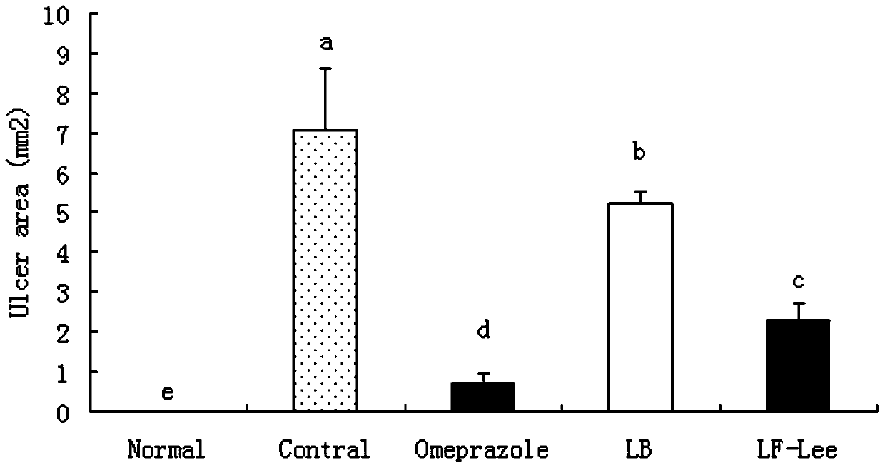 A lactobacillus fermentum strain Lee capable of preventing gastric ulcer and its health care application