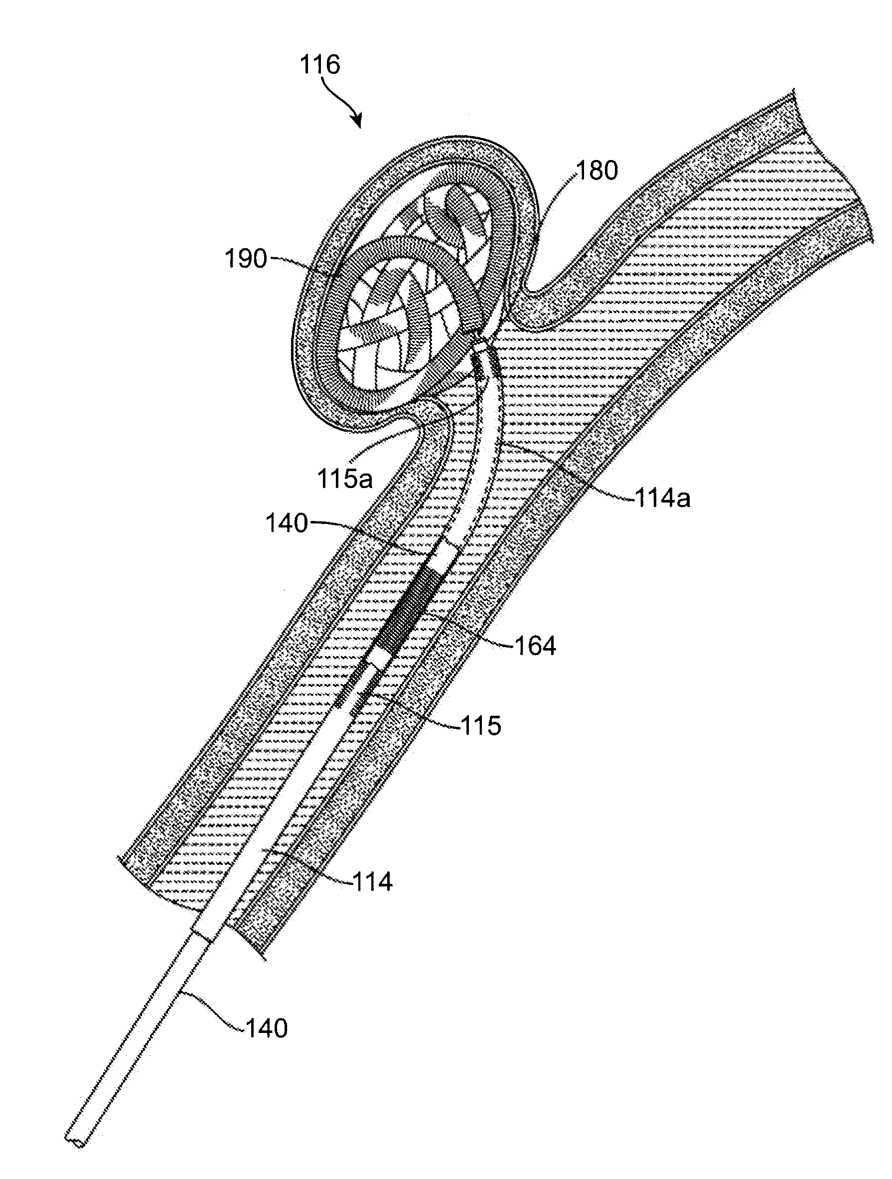 Implant, a mandrel, and a method of forming an implant