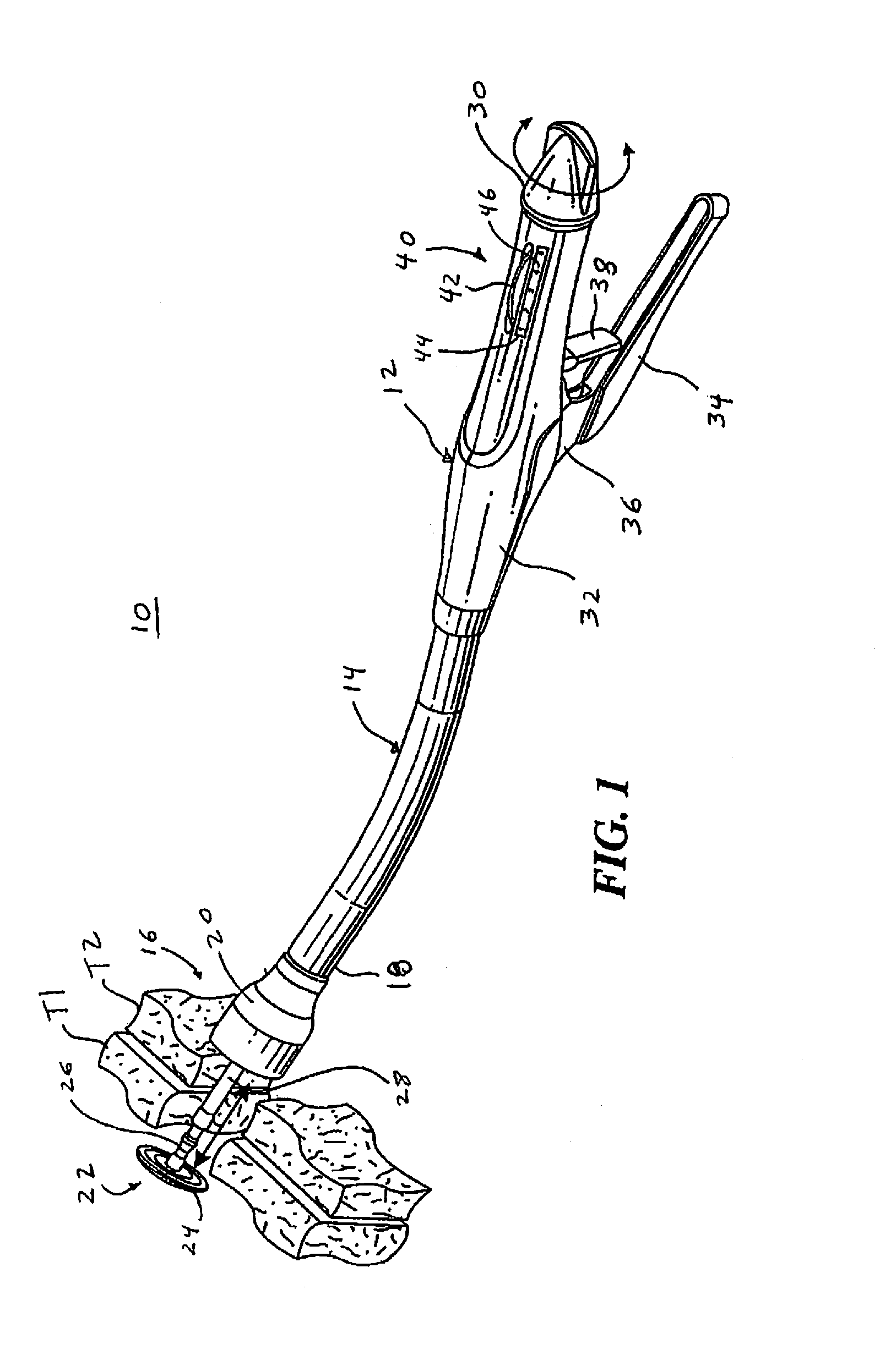 Circular Stapler with Controlled Tissue Compression