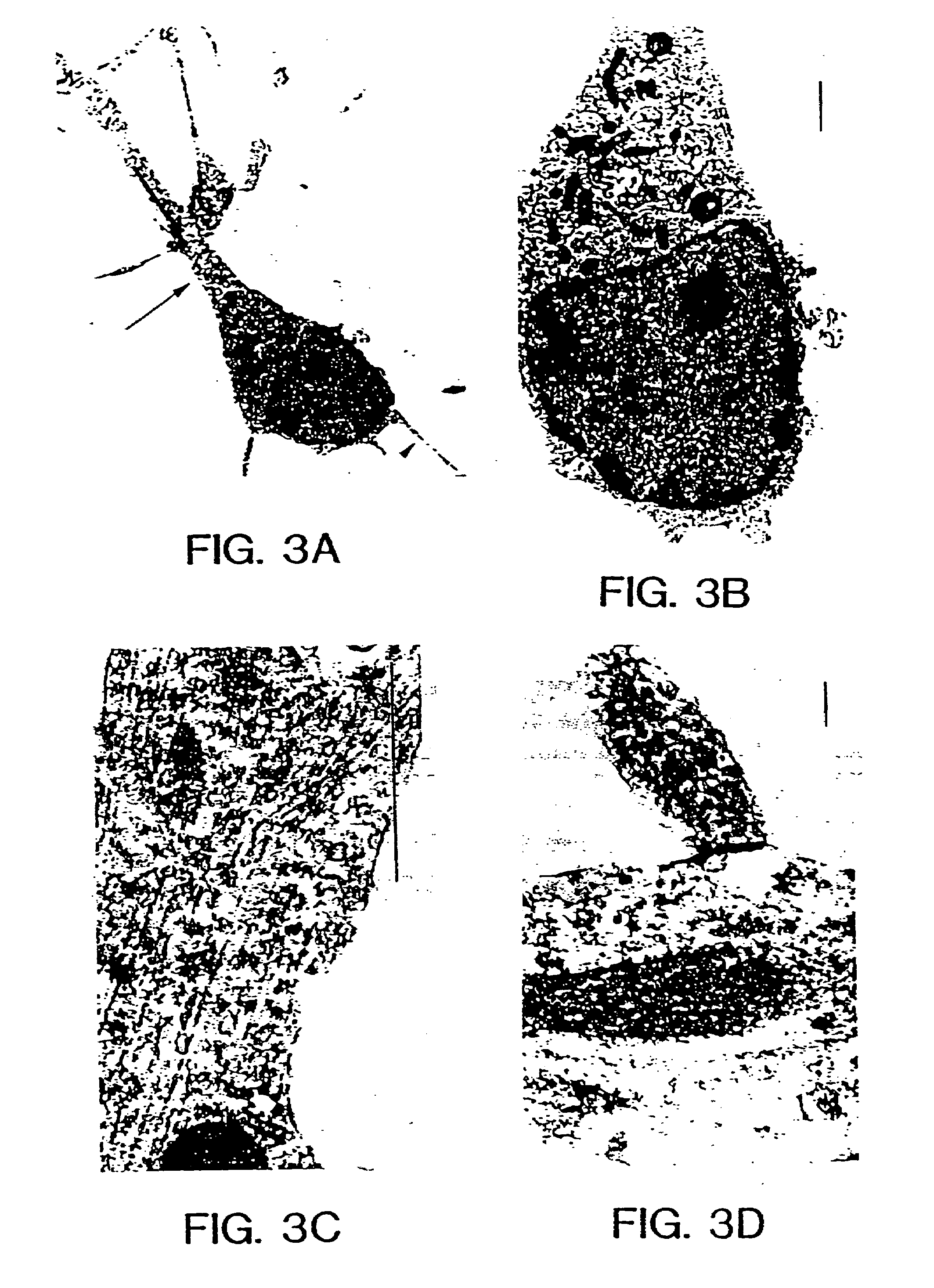 Method for production of neuroblasts