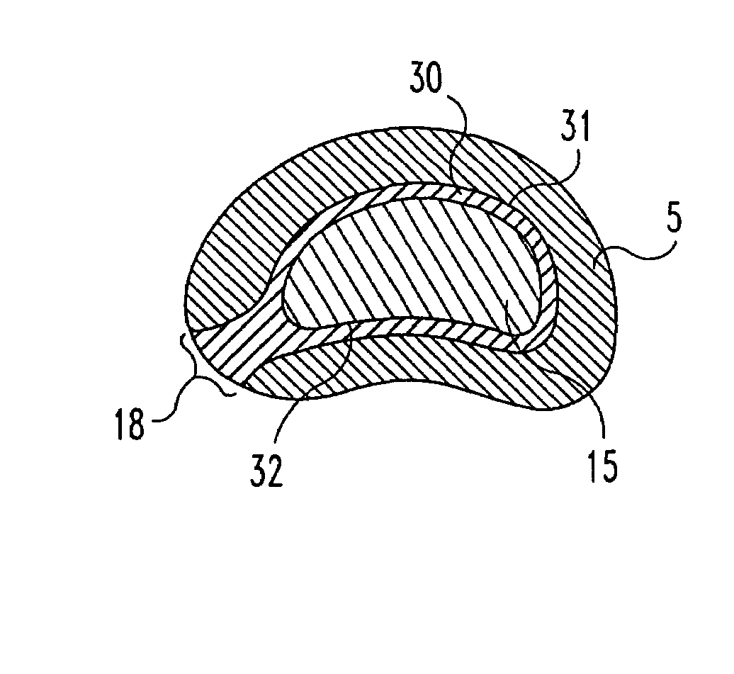 Methods for forming and retaining intervertebral disc implants