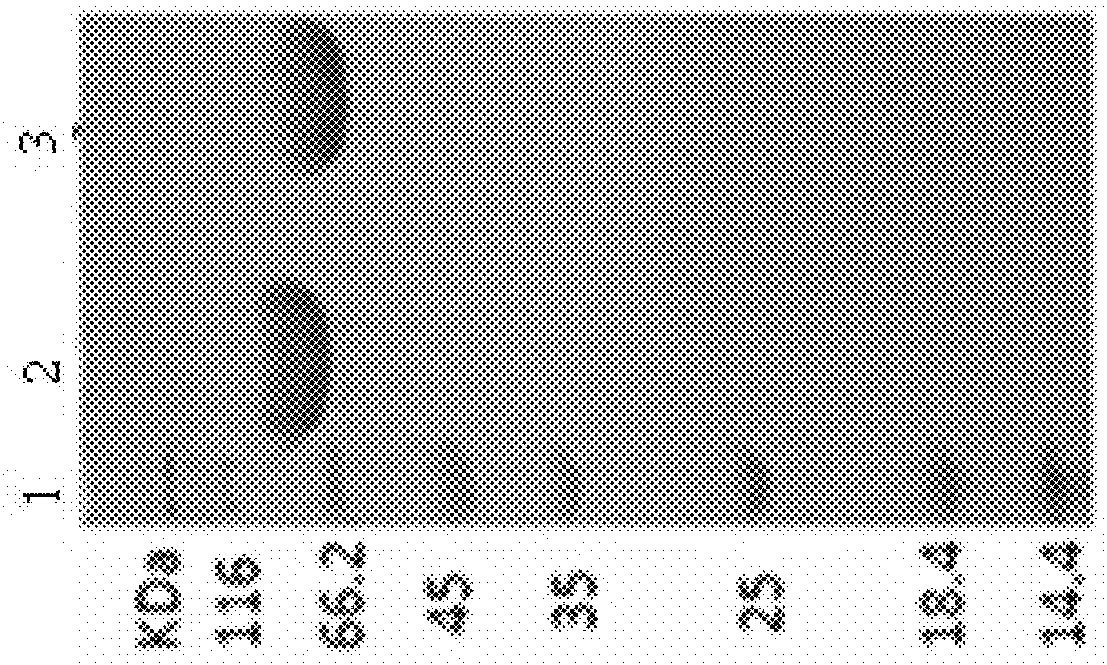 Slit2d2-hsa fusion protein and use thereof against tumours