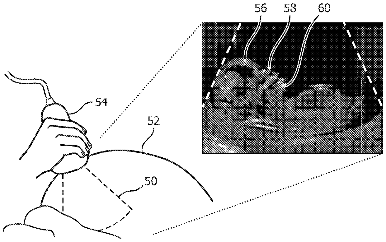 Imaging system and method for localizing a 3d ultrasound volume in a desired orientation