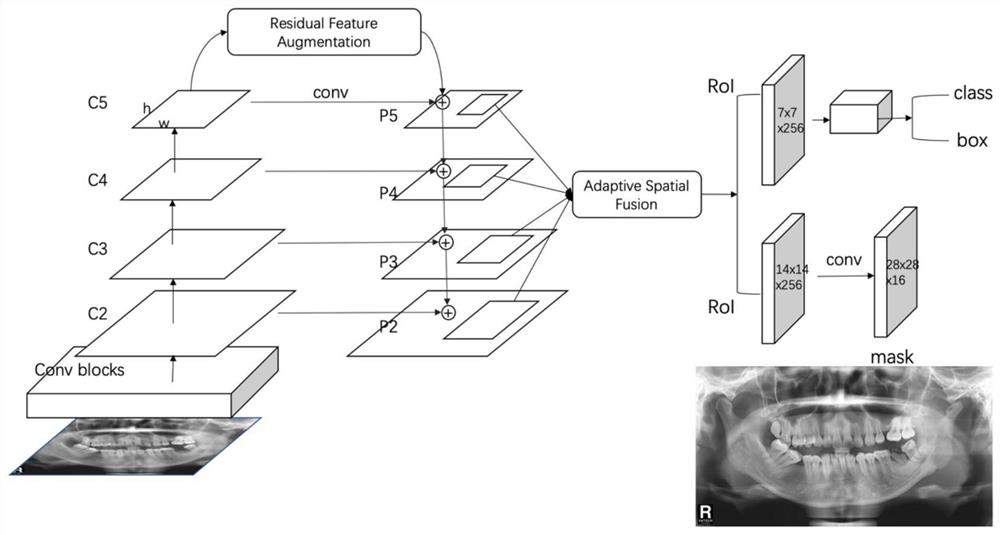 Panoramic dental film focus detection and segmentation method and device for deep learning
