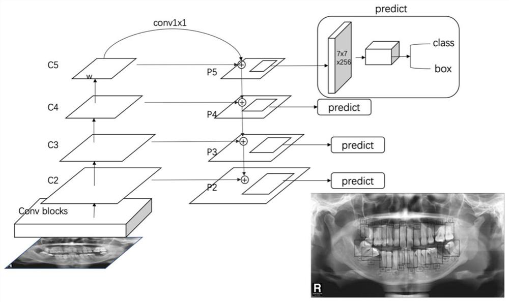 Panoramic dental film focus detection and segmentation method and device for deep learning