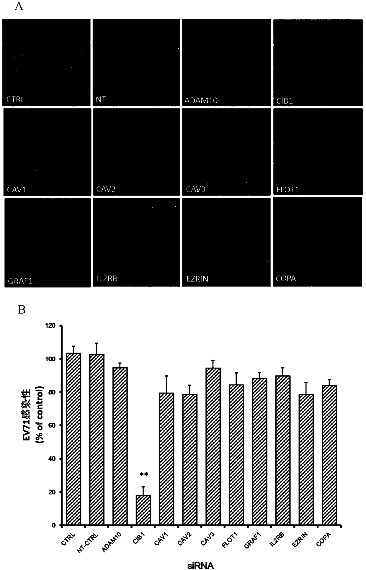Application of calcium integrin binding protein 1 in preventing and treating enterovirus 71 infection