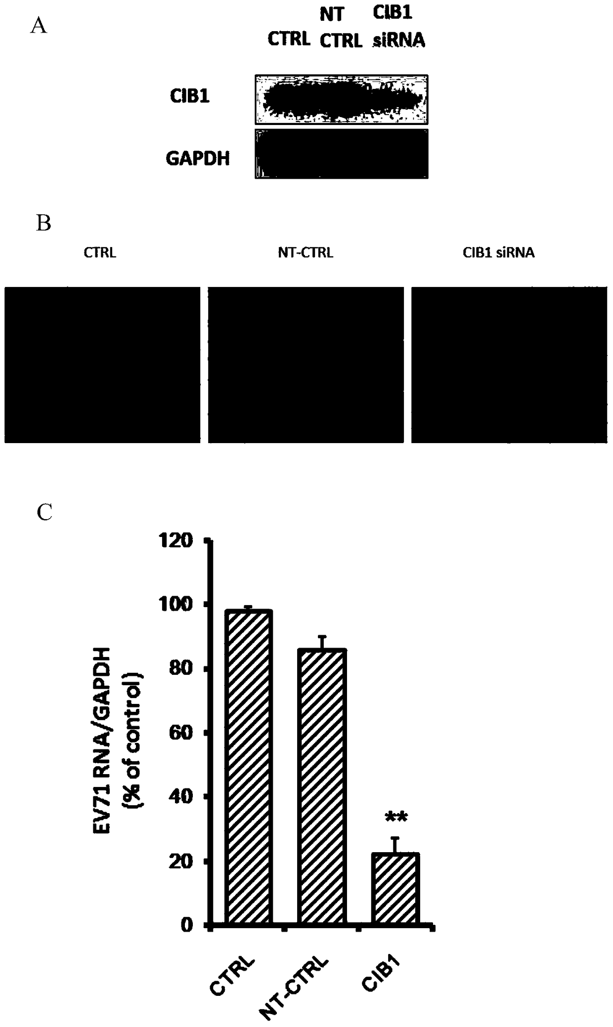 Application of calcium integrin binding protein 1 in preventing and treating enterovirus 71 infection