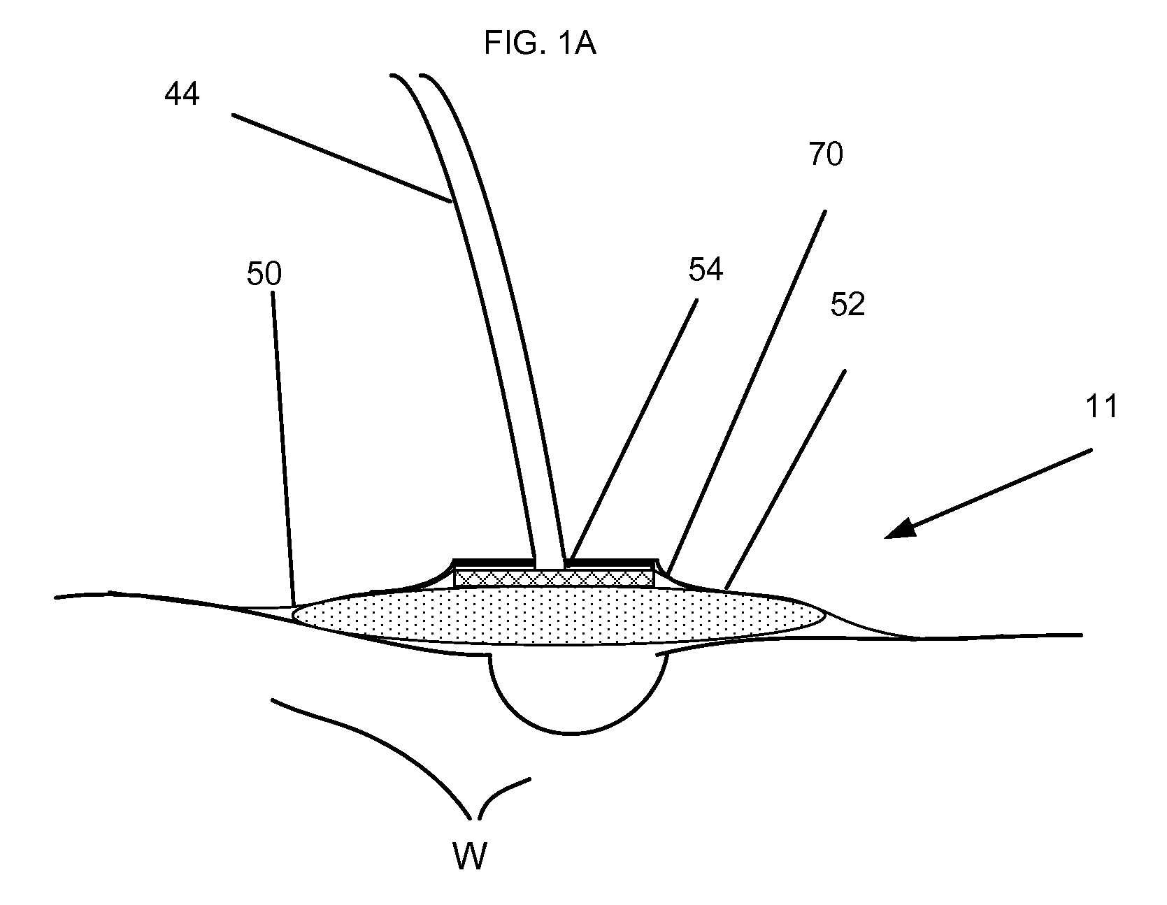 Pump leak monitor for negative pressure wound therapy