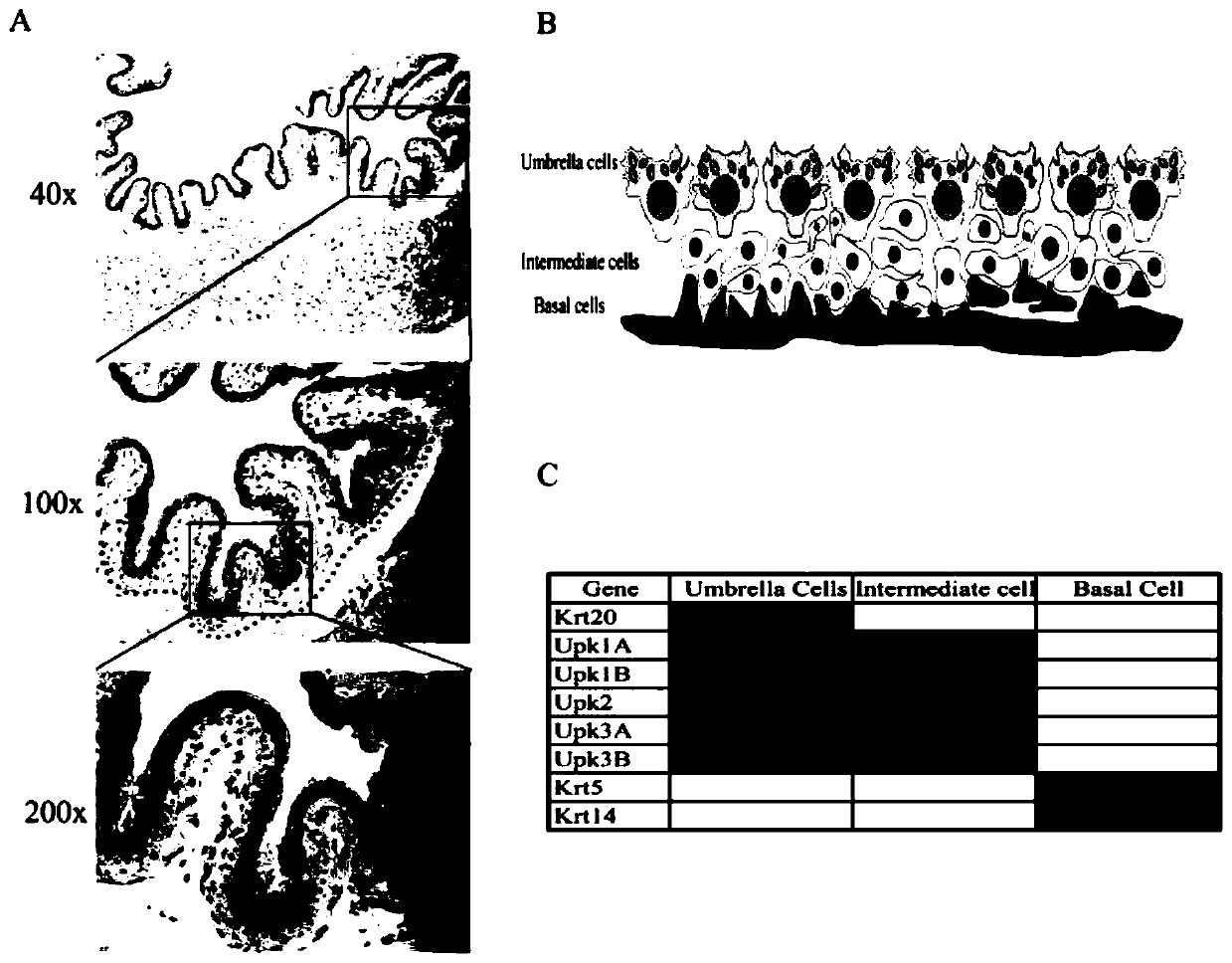 Production method and application of bladder urothelium single-cell suspension used for single-cell sequencing