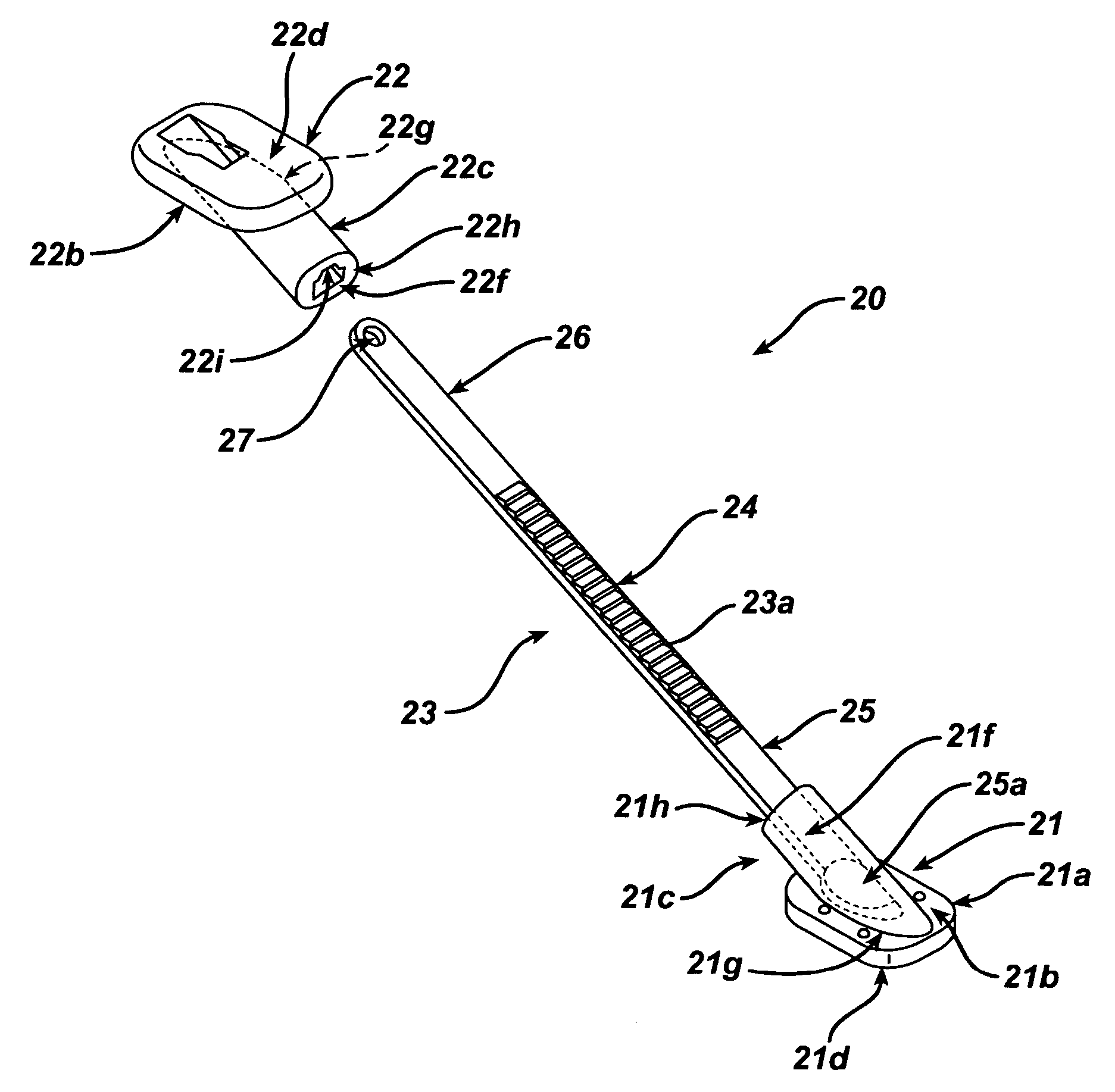 Sternal closure device and method