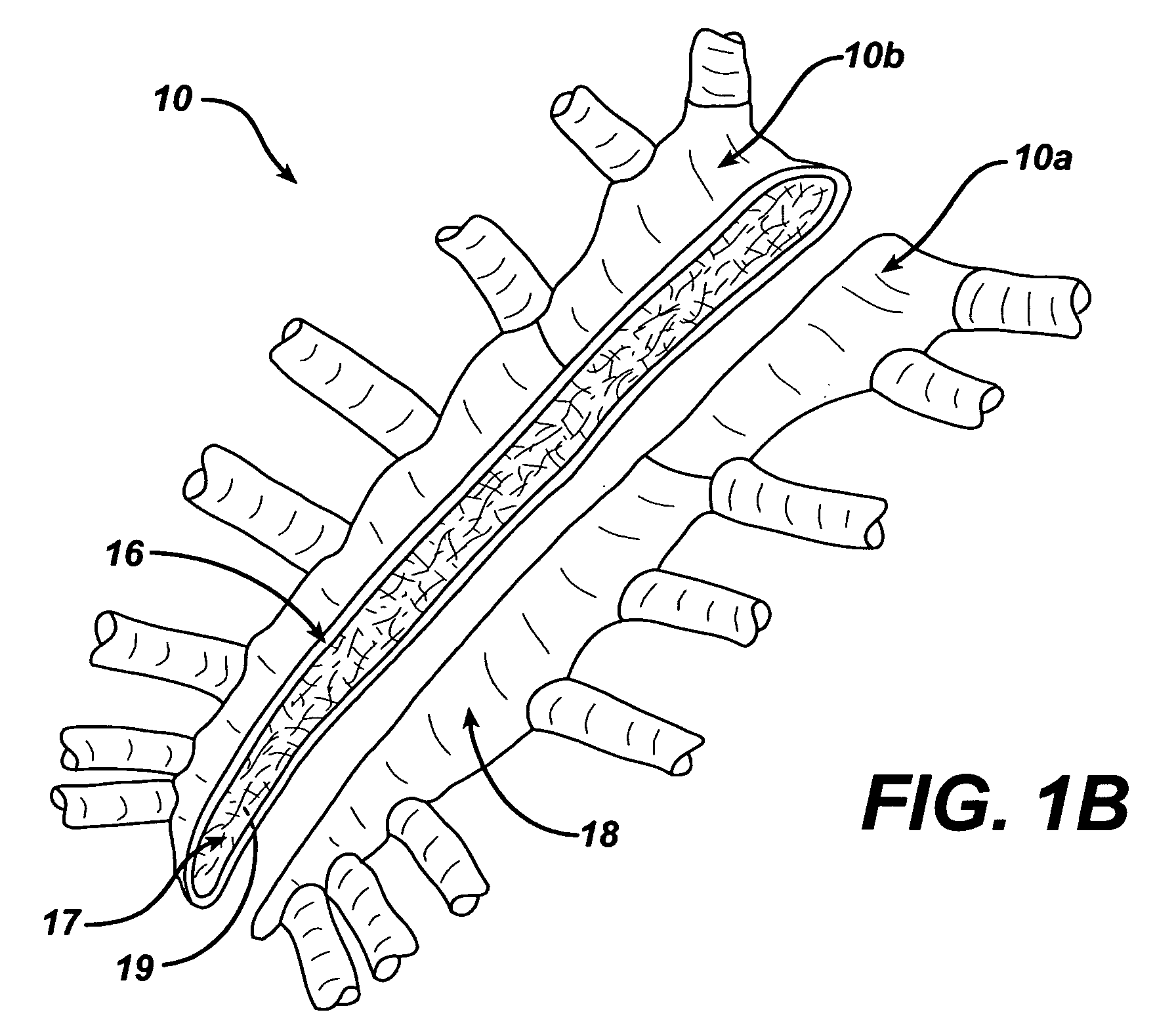 Sternal closure device and method