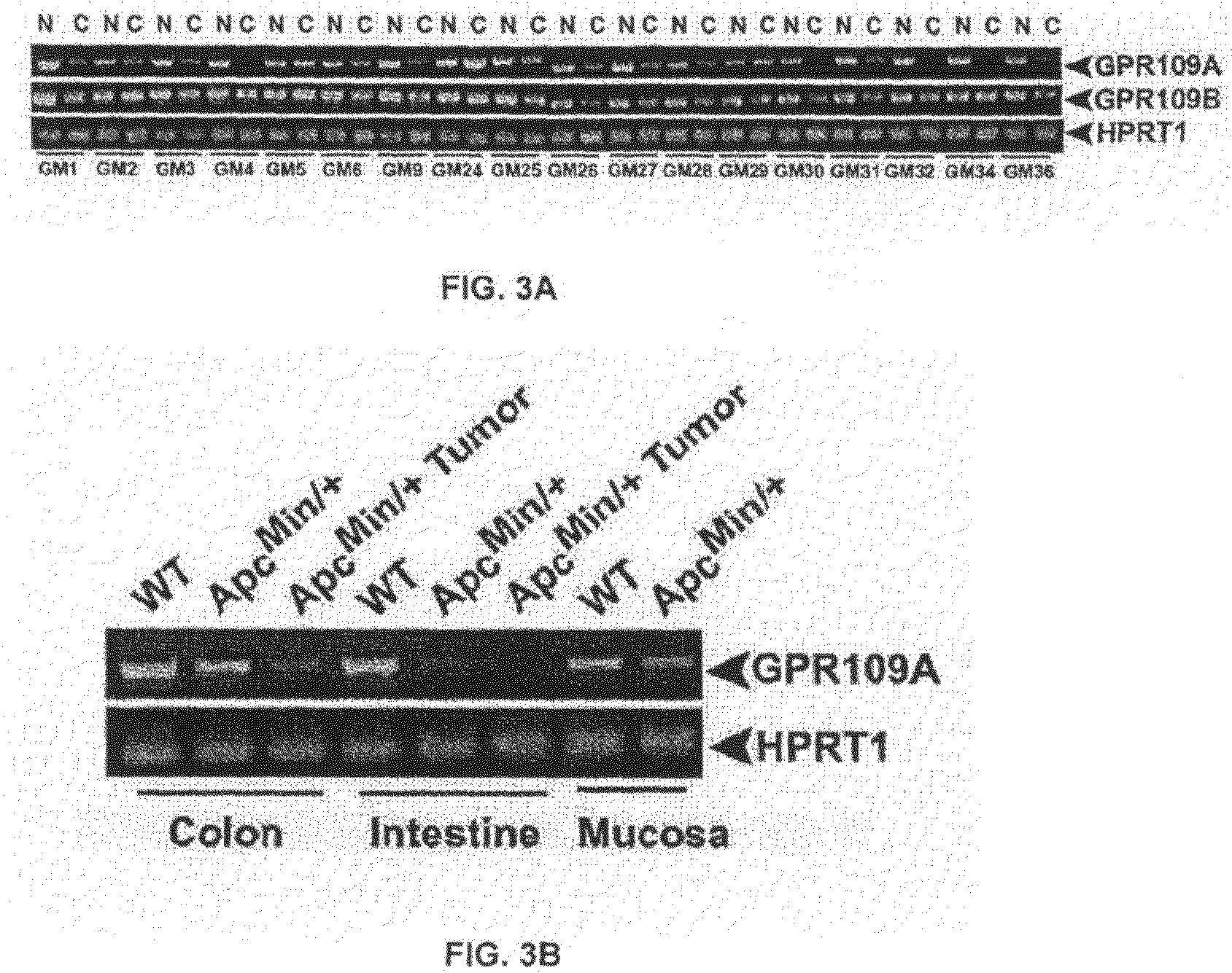 Compositions Comprising a GPR109 Ligand For Treating Disorders of the Digestive Tract and/or Cancer