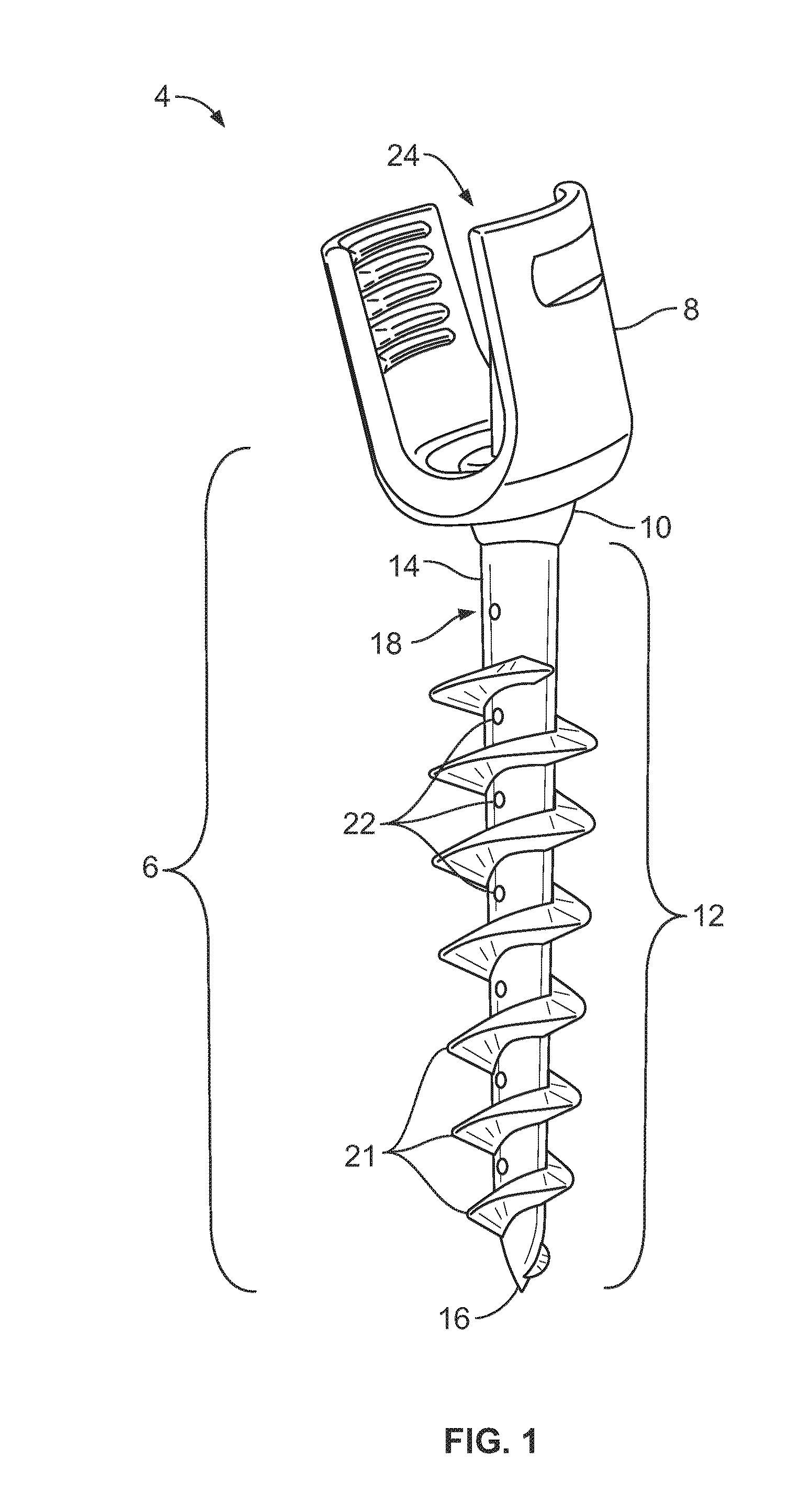 Composite Metal and Bone Orthopedic Fixation Devices