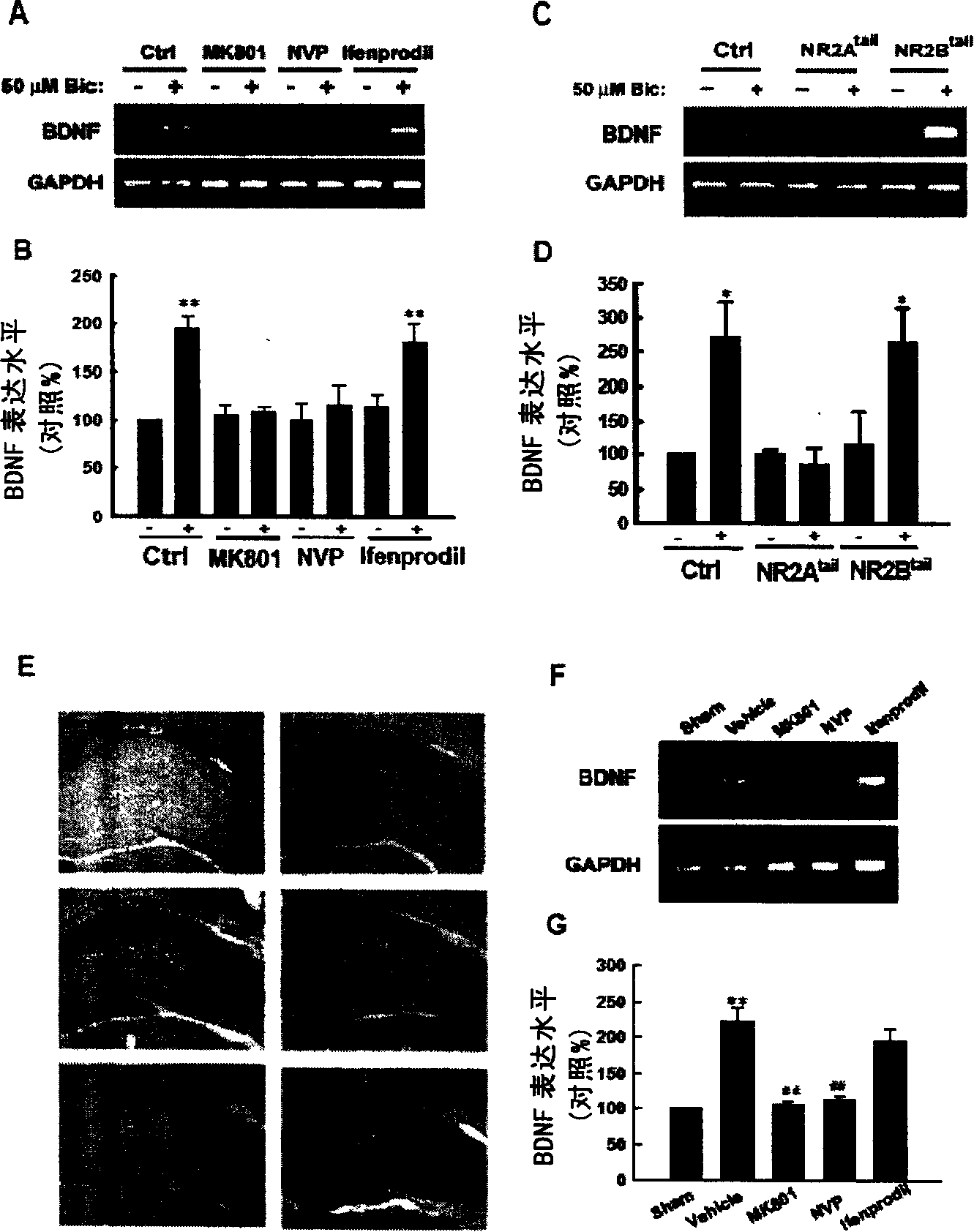 Effect of N-methyl-D-asparagic acid acceptor in epilepsy generation